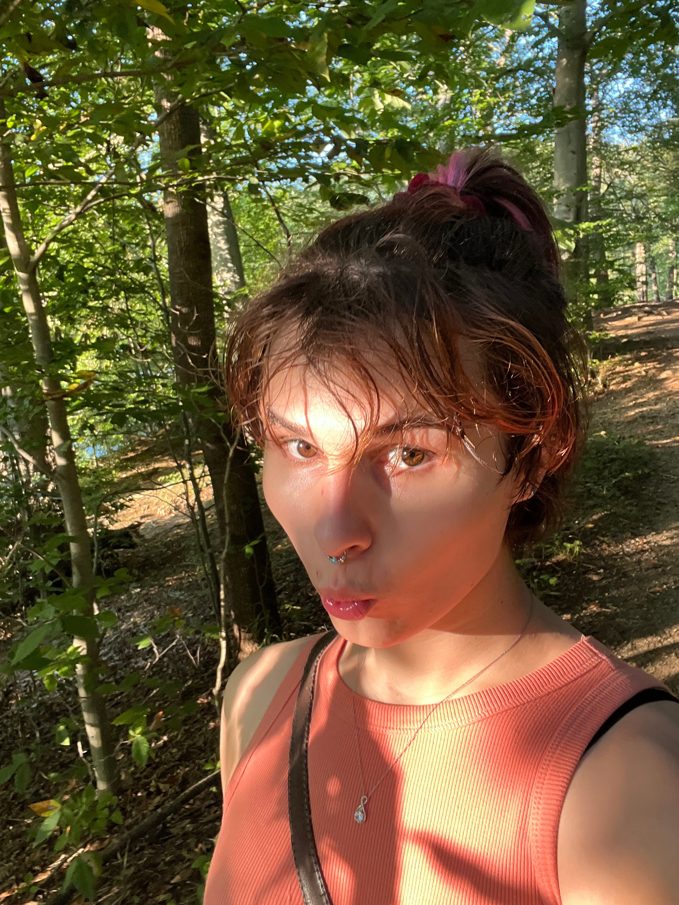Donate to Liv's Surgery and Recovery Fund campaign photo, 2 of 8
