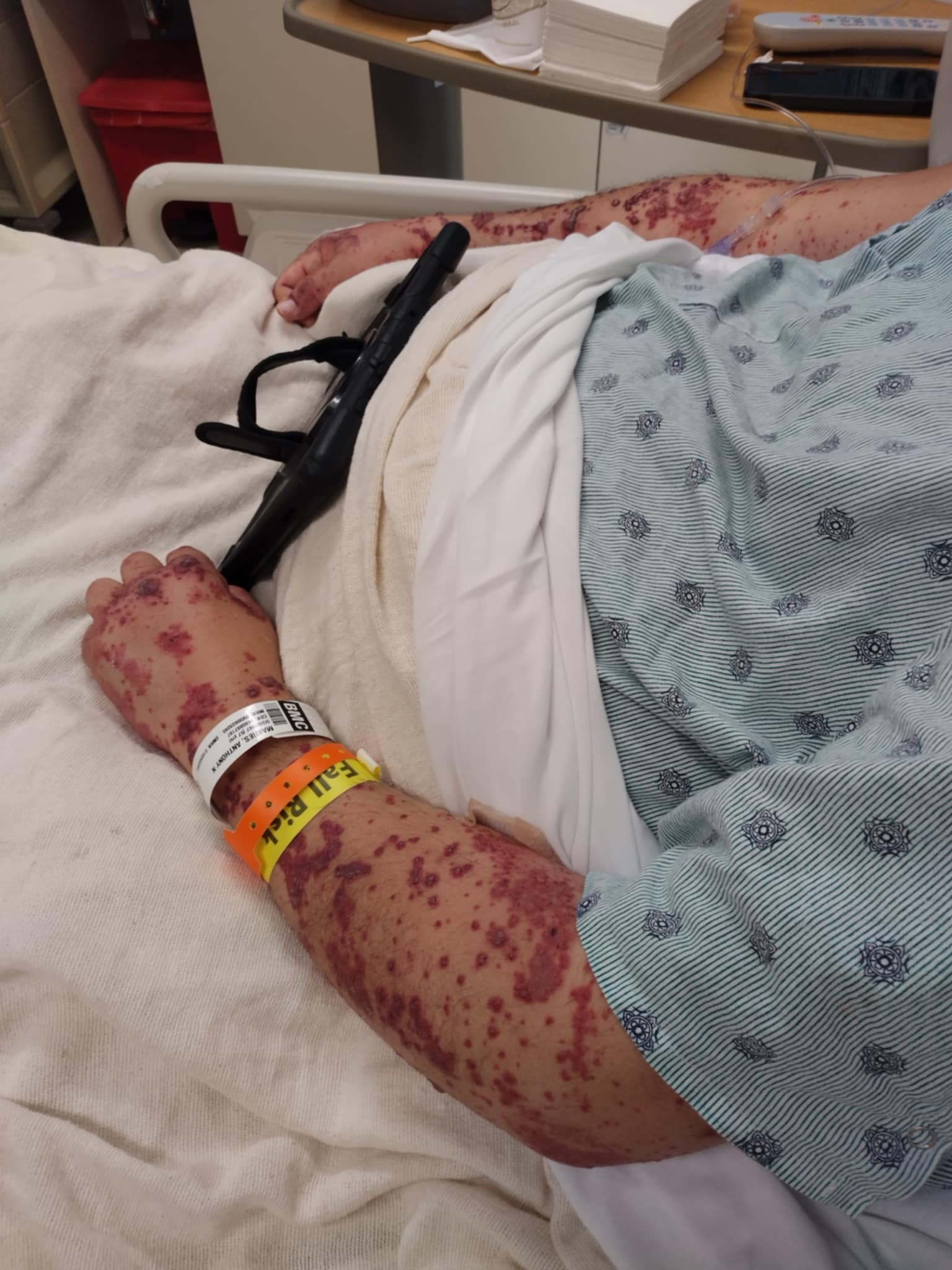 Support Anthony Makres' Urgent Medical Journey campaign photo, 4 of 6