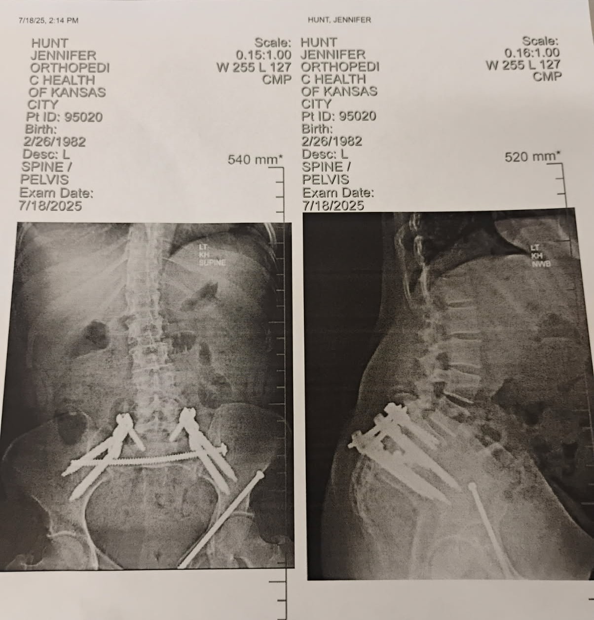 Help after critical accident & long hospital stay campaign photo, 5 of 6