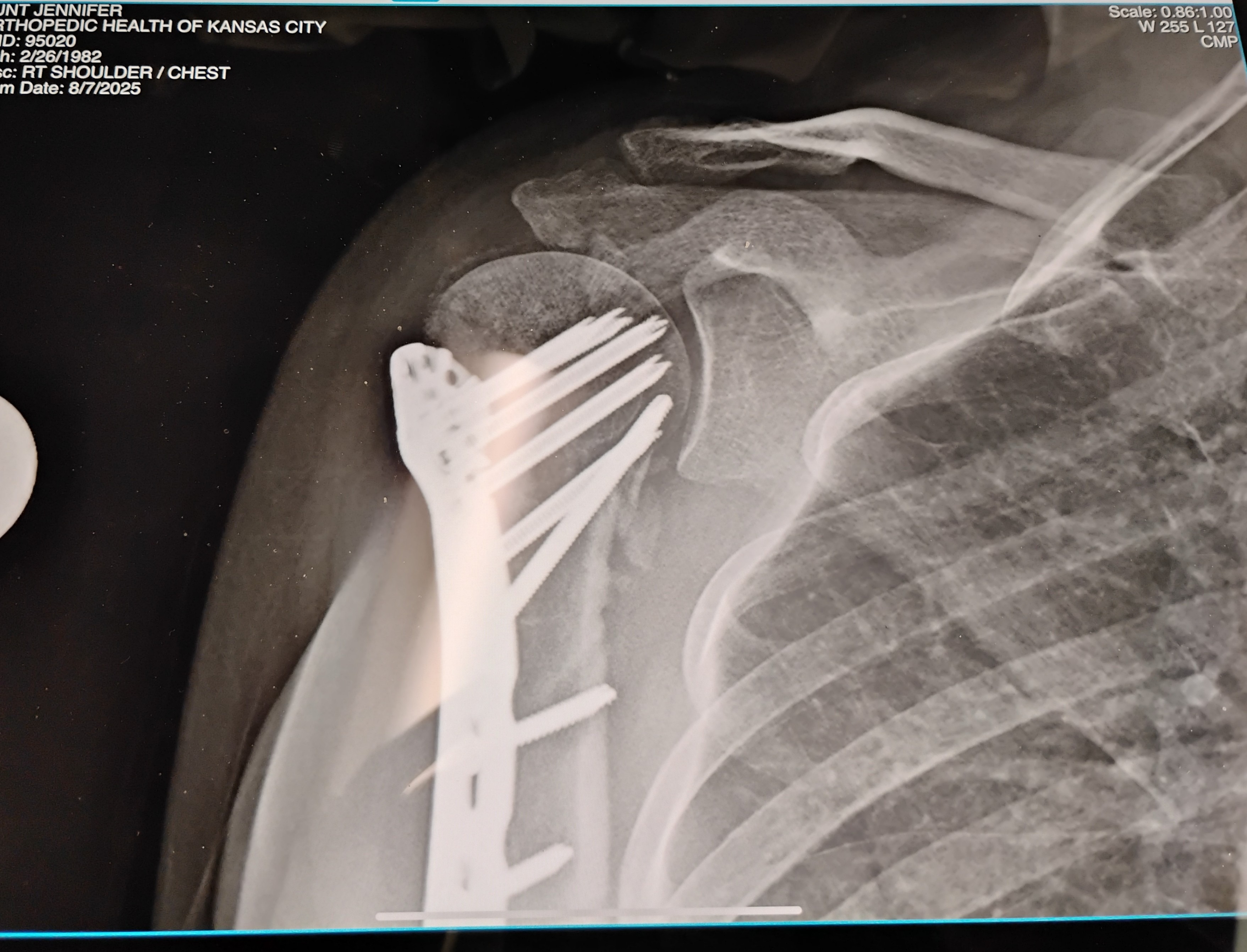 Help after critical accident & long hospital stay campaign photo, 2 of 6