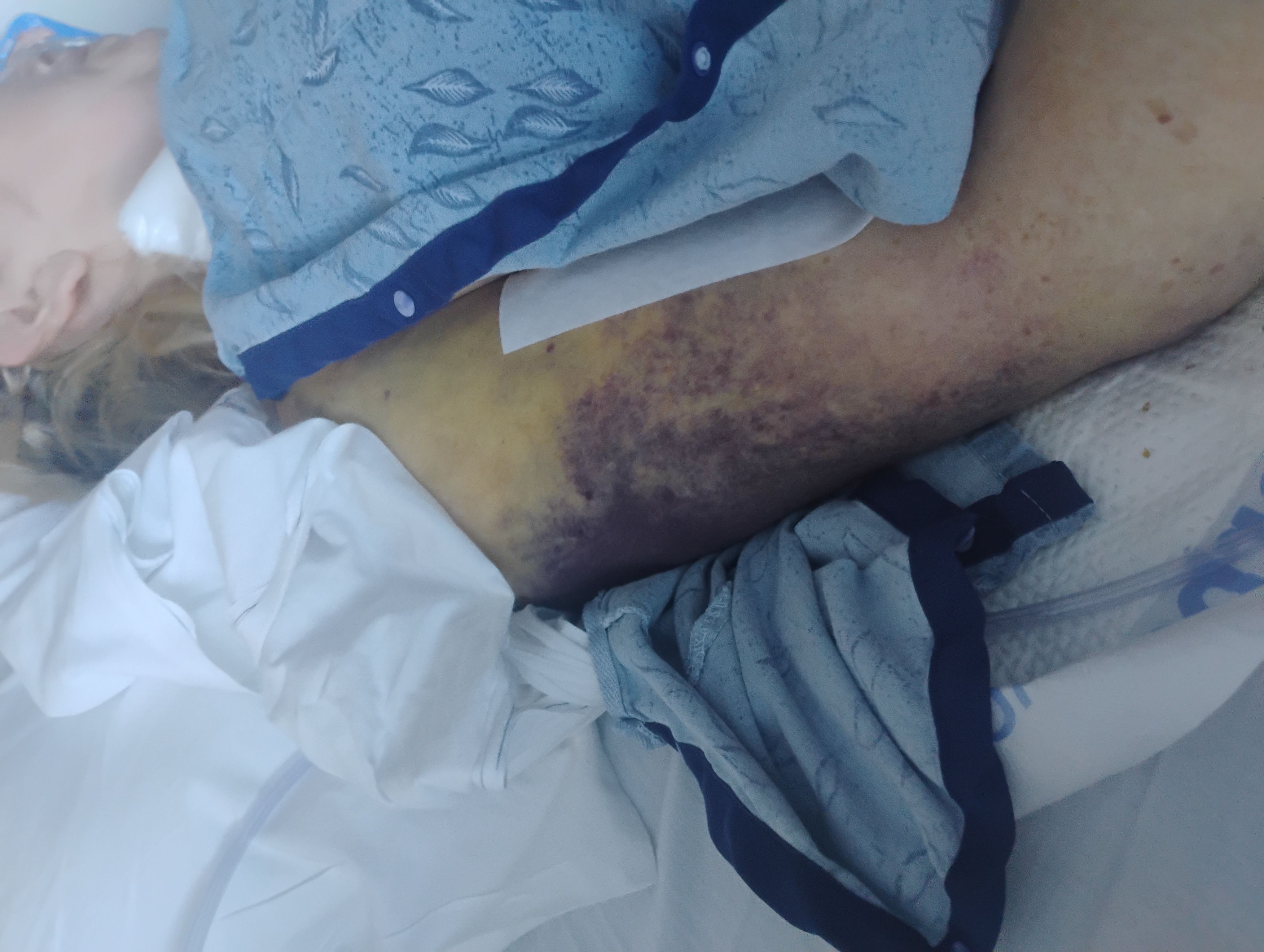 Help after critical accident & long hospital stay campaign photo, 4 of 6