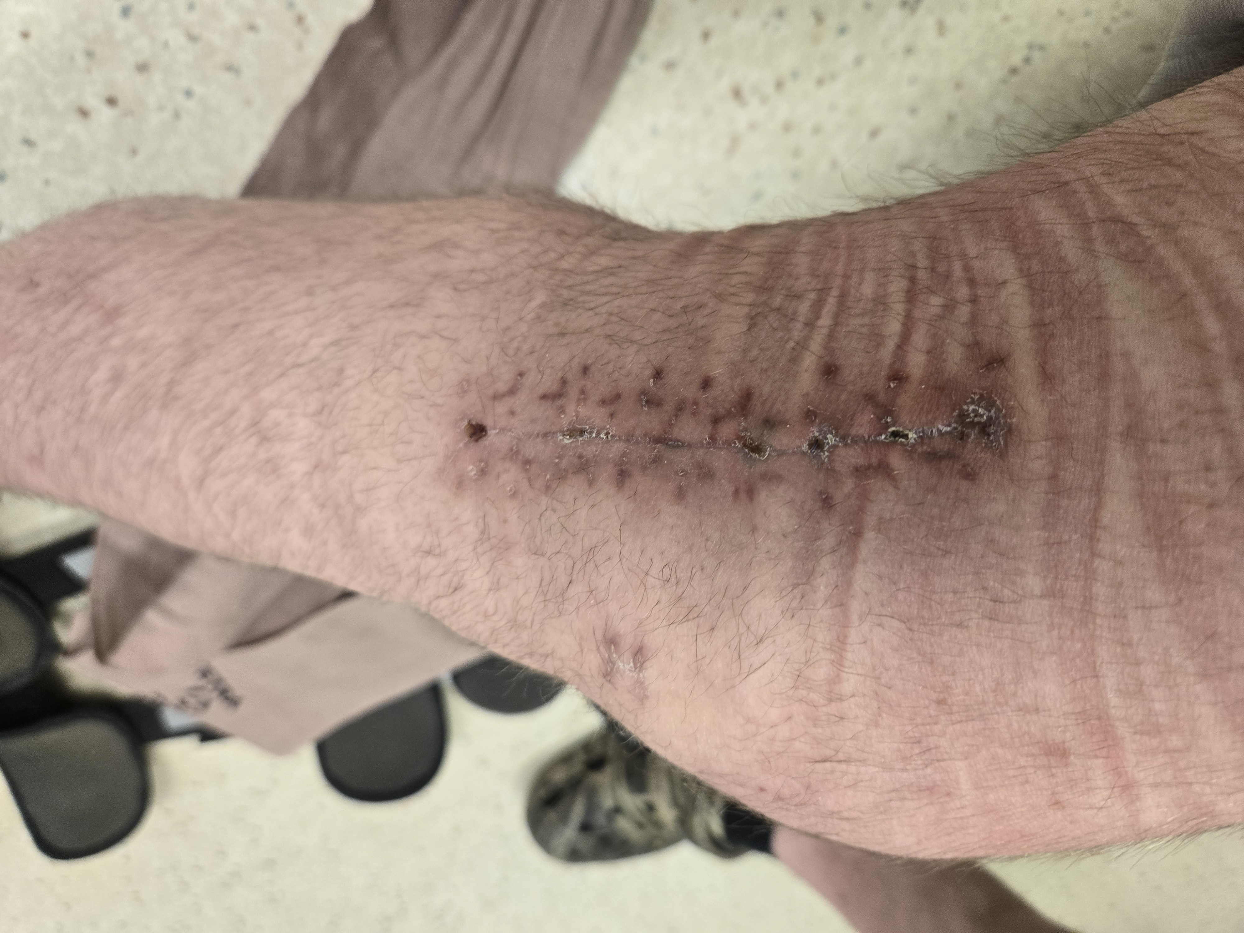 Support Thomas On His Road To Recovery. campaign photo, 5 of 8