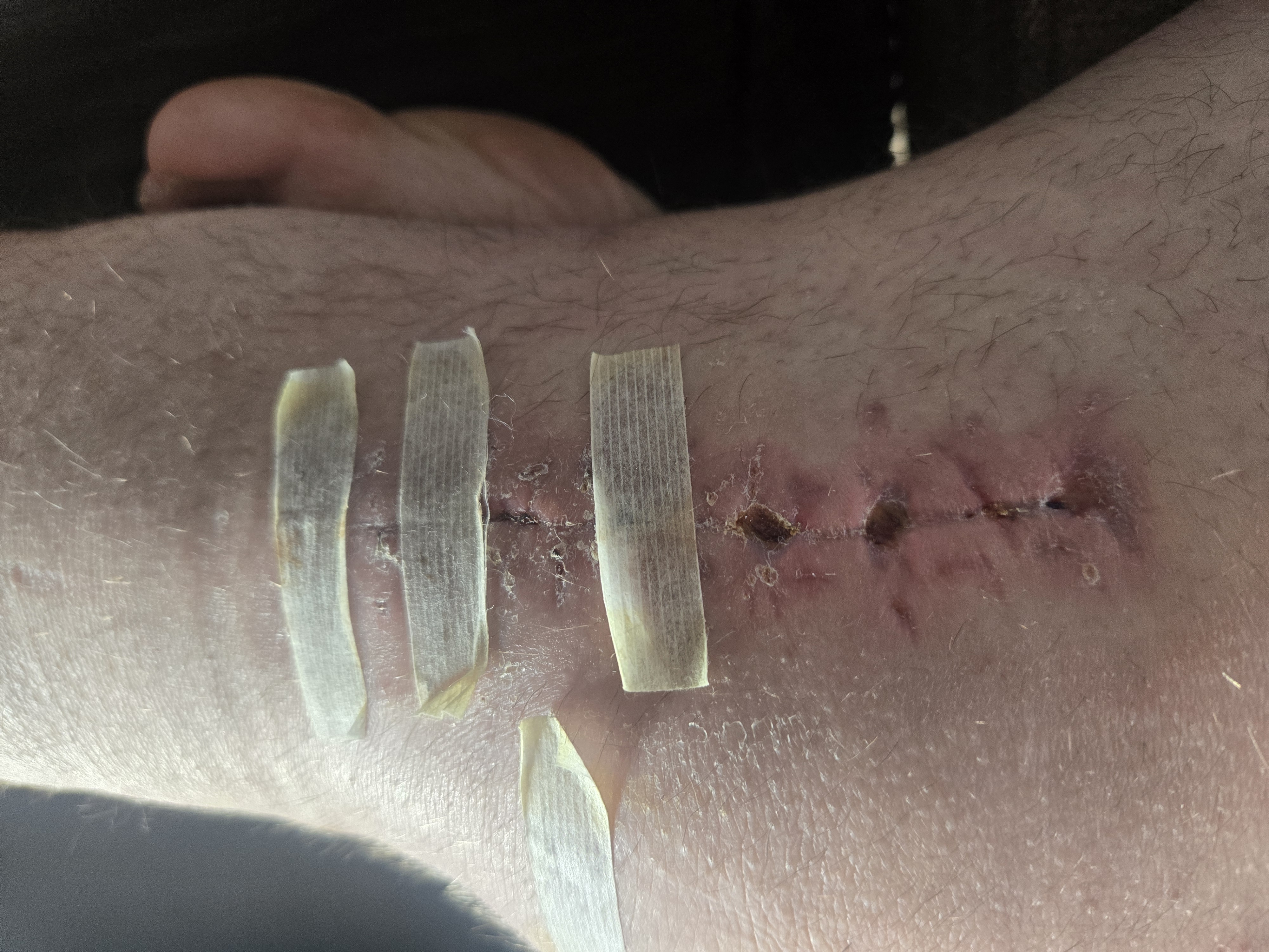 Support Thomas On His Road To Recovery. campaign photo, 6 of 8