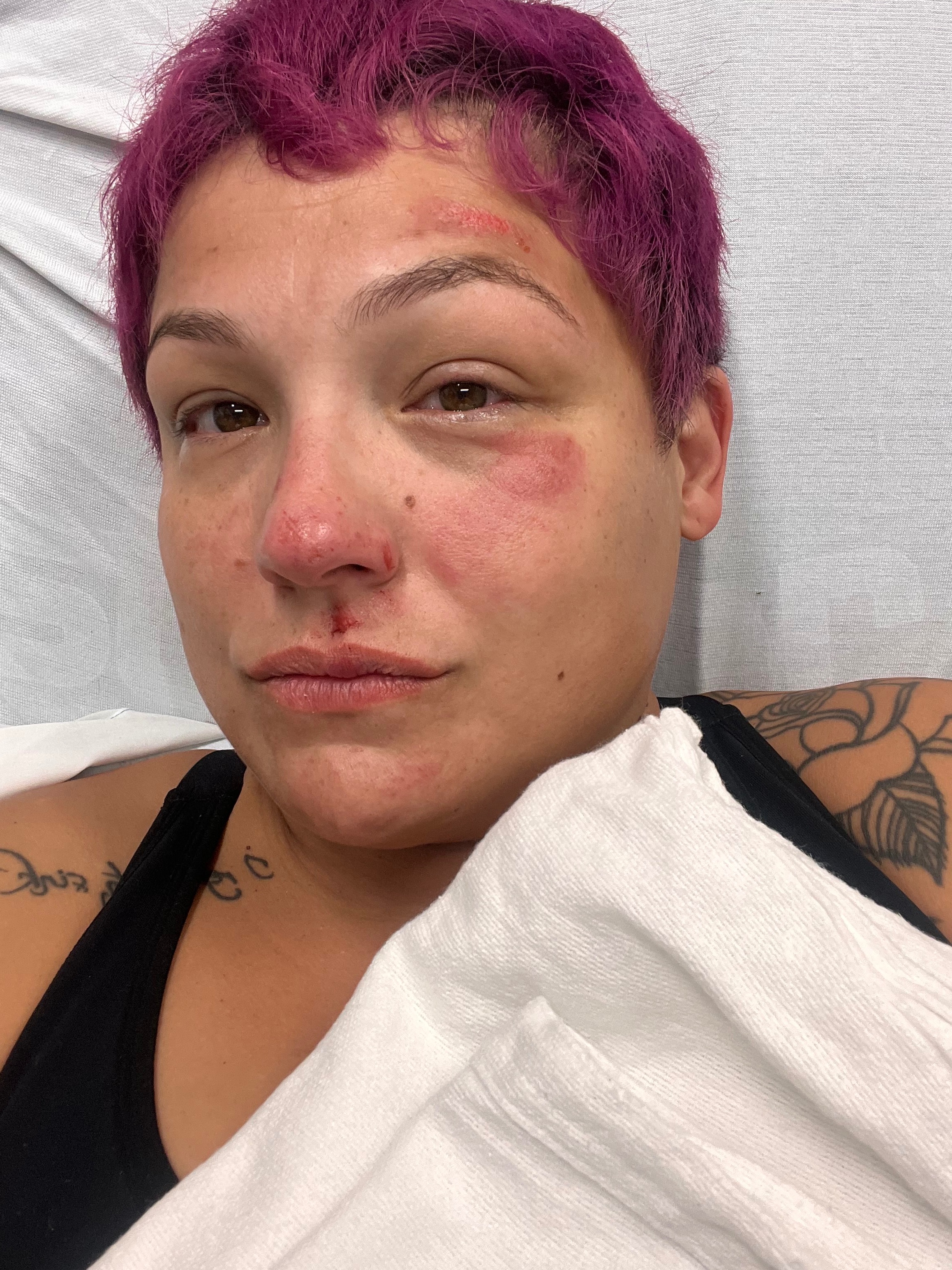 Help Ramona heal after a traumatic accident campaign photo, 5 of 8