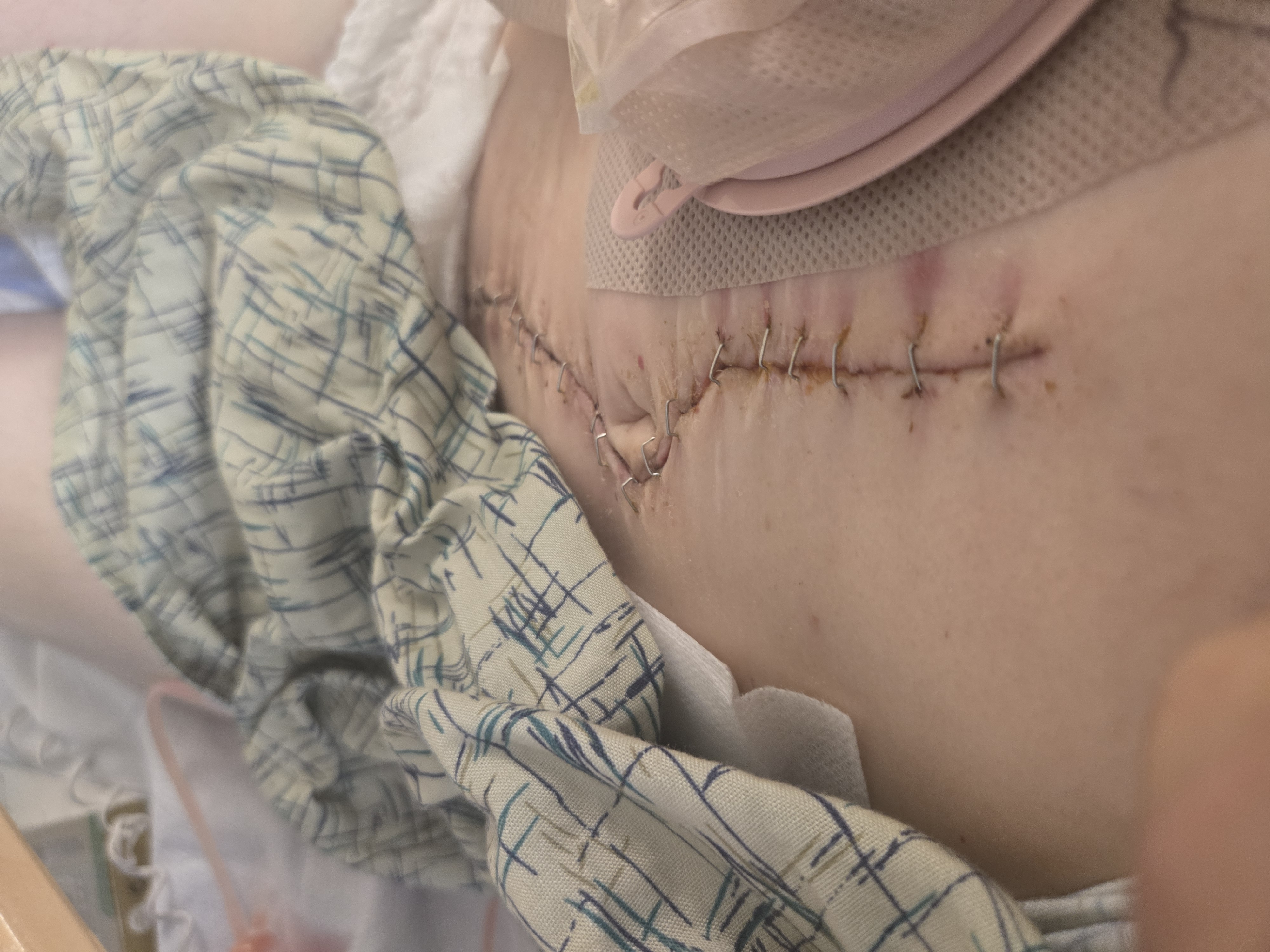 Help Jonathan Gehrt and Family Through Surgery campaign photo, 5 of 7
