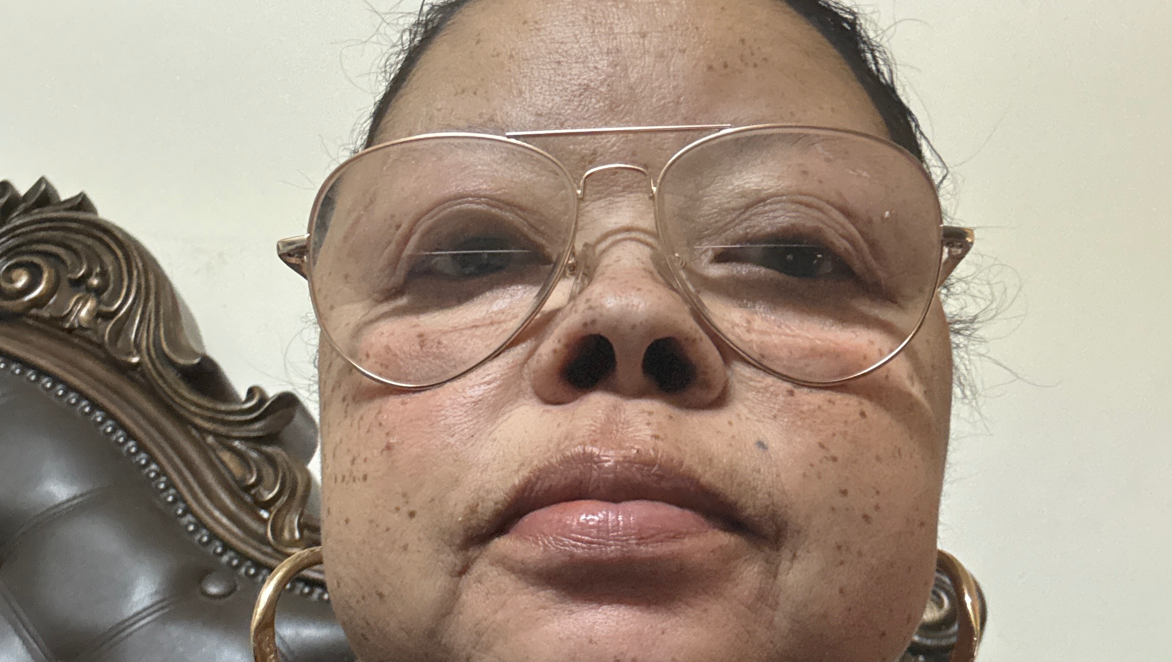 Help me get dentures because I can’t afford them photo