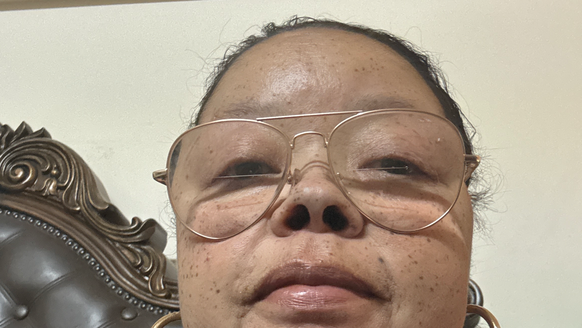 To help me get dentures I can’t afford them they cost a lot photo