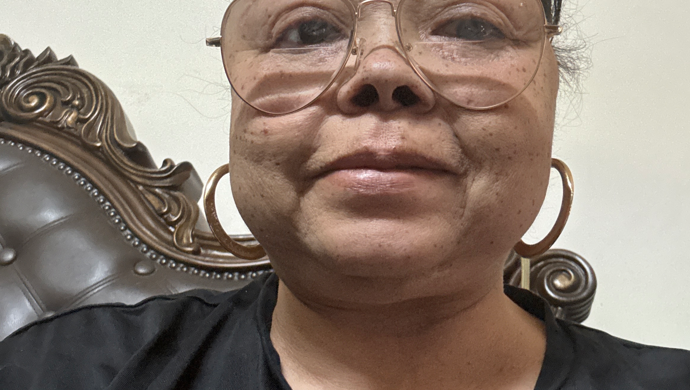 I really want to have dentures but I can’t afford them photo