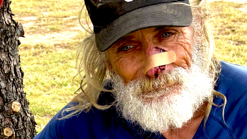 Hope begins for you, when we choose not to look away photo