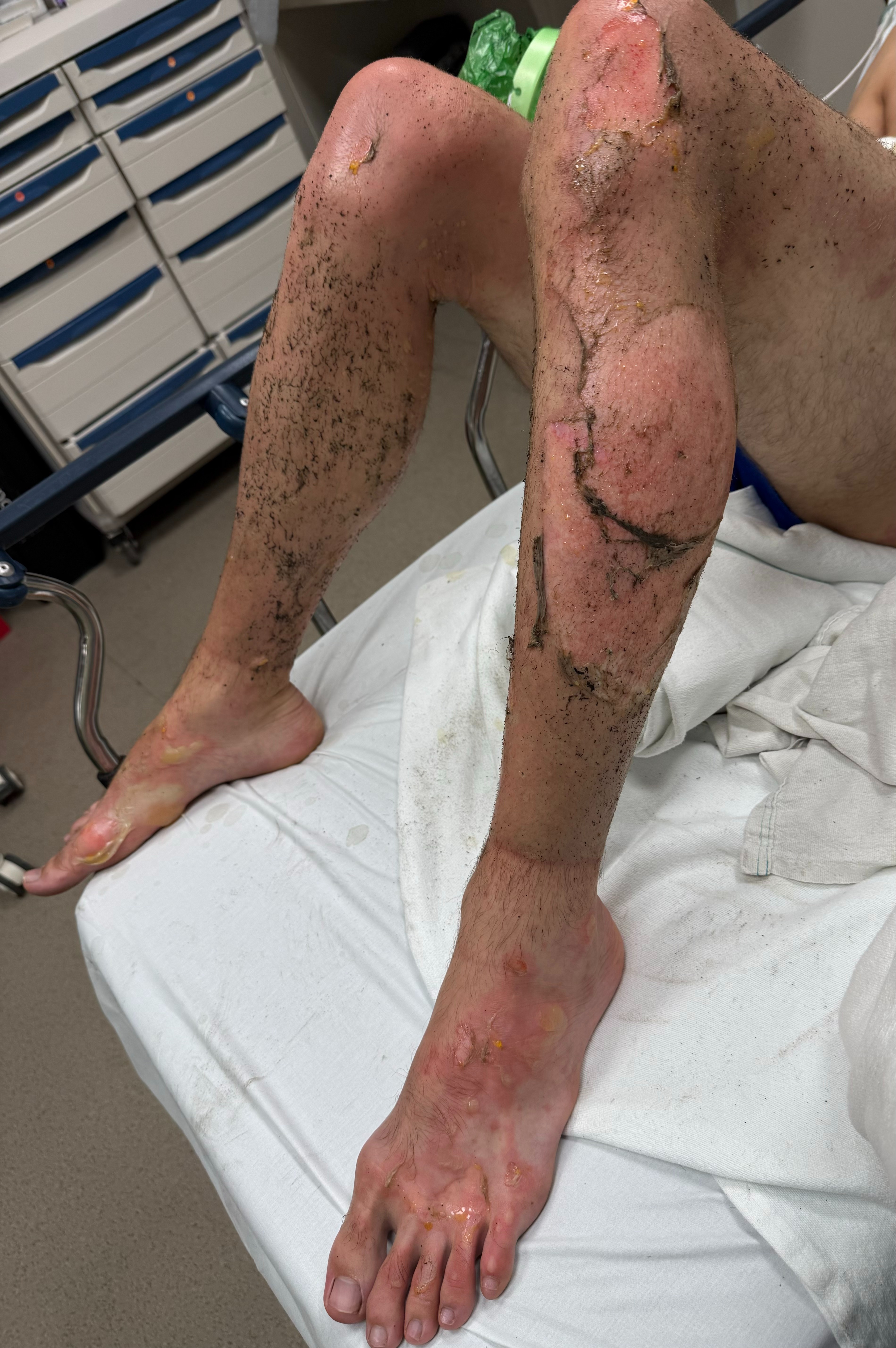 Donate to Pavlo Sych's Medical Expenses campaign photo, 2 of 7