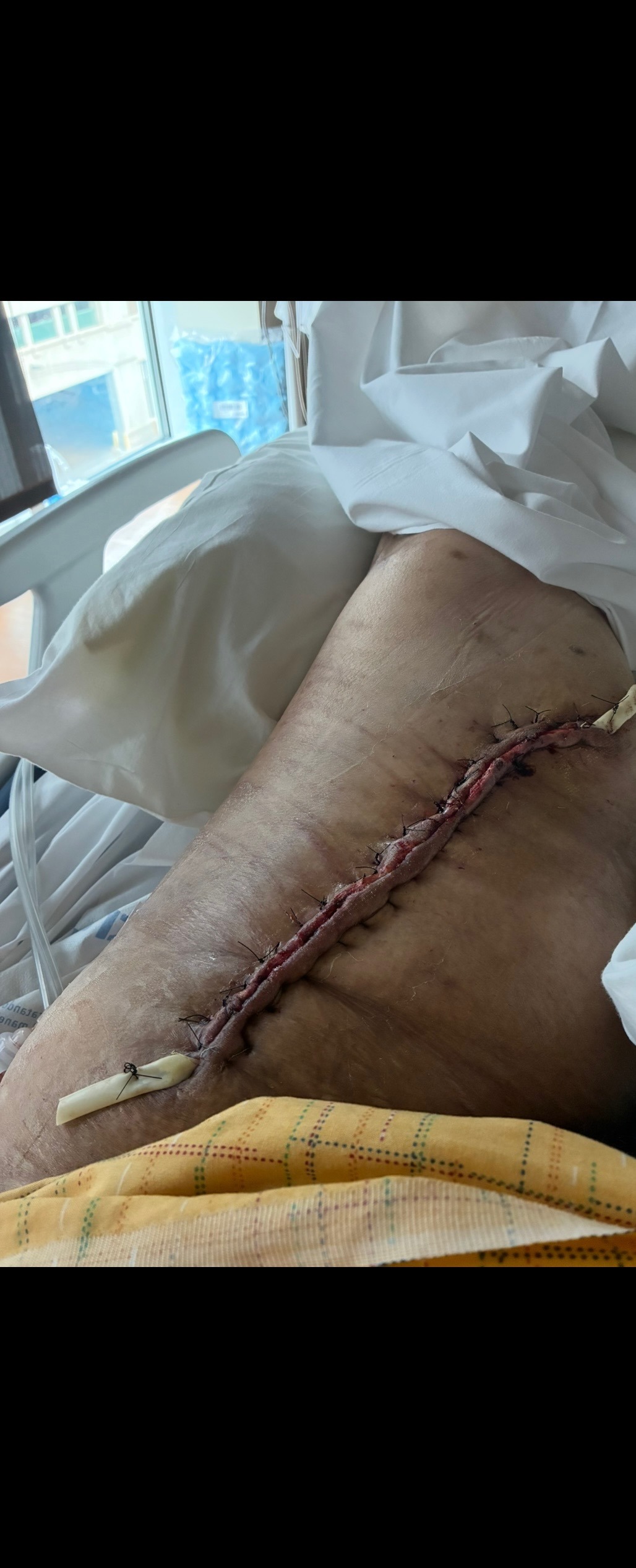 Support Angelica Lucero Barton's Road to Recovery campaign photo, 2 of 7