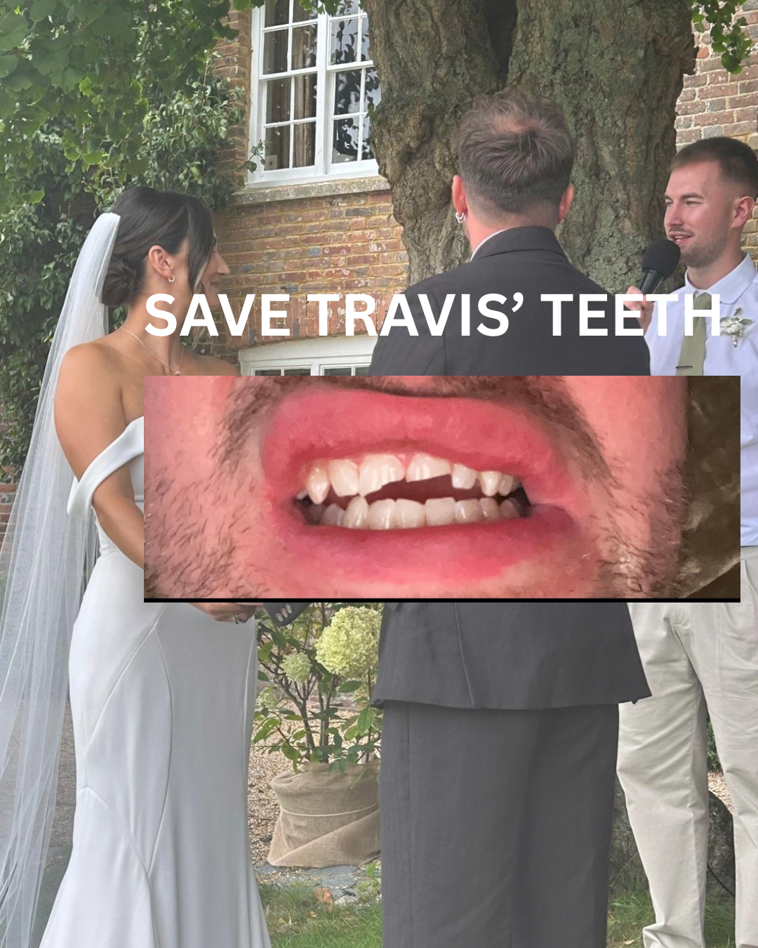 ‘Travith’ our Officiant knocked his teeth out… campaign photo, 2 of 5