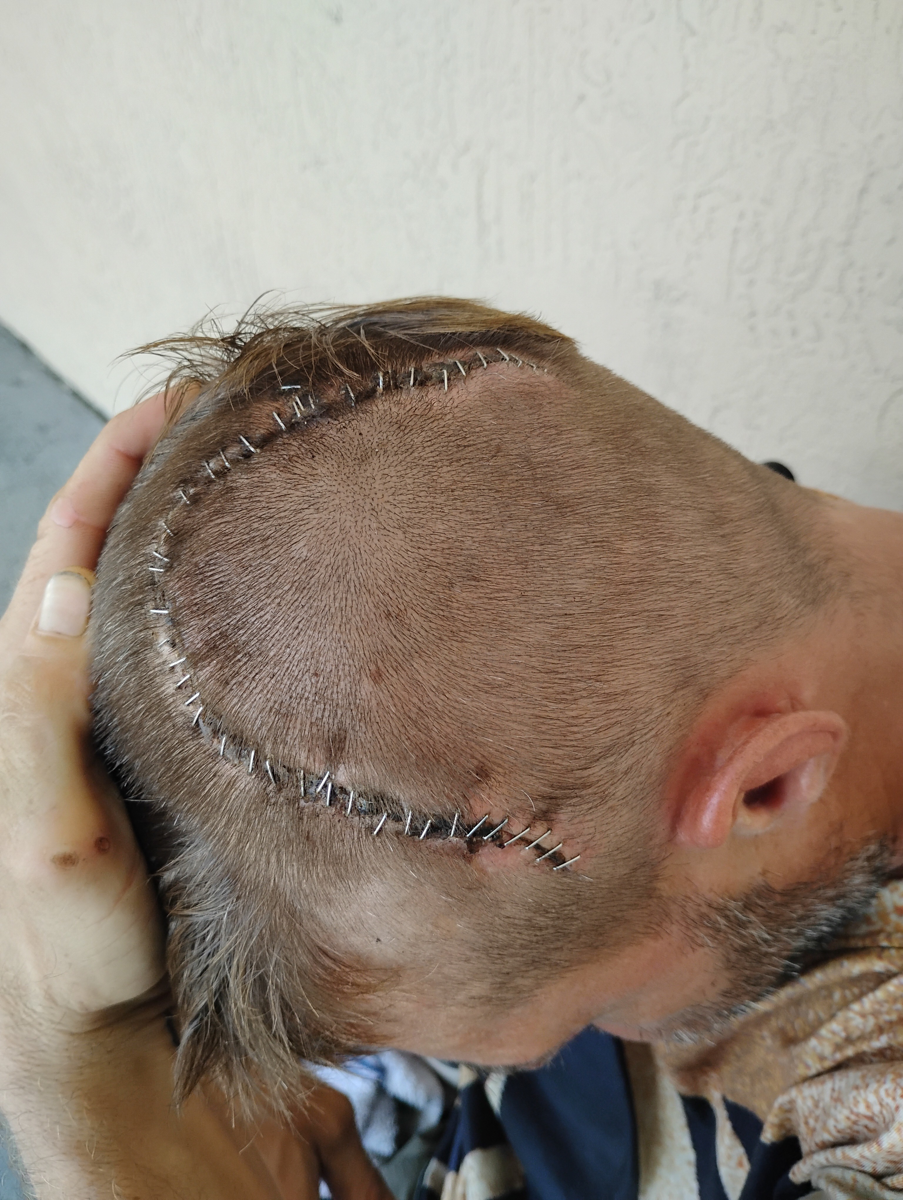 Support Chad's Journey to Overcome Tragedy campaign photo, 4 of 5