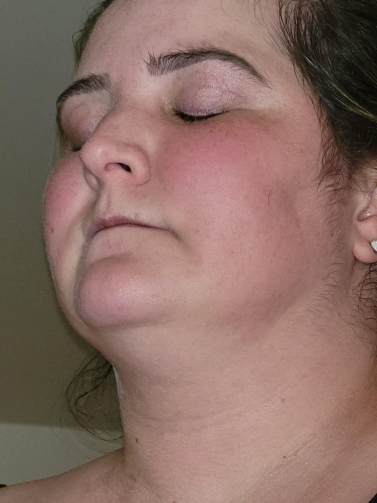 Aid a Nurse Battling Autoimmune Diseases campaign photo, 2 of 7