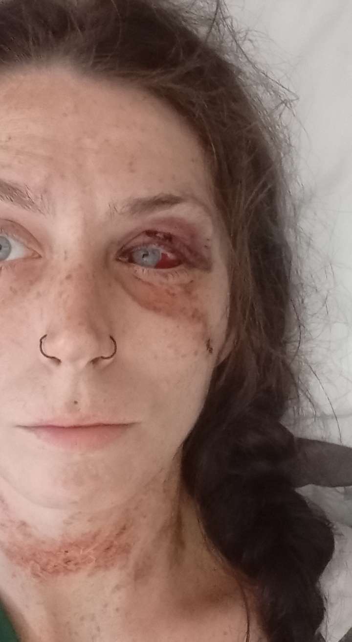 Cheyanne’s recovery campaign photo, 4 of 8