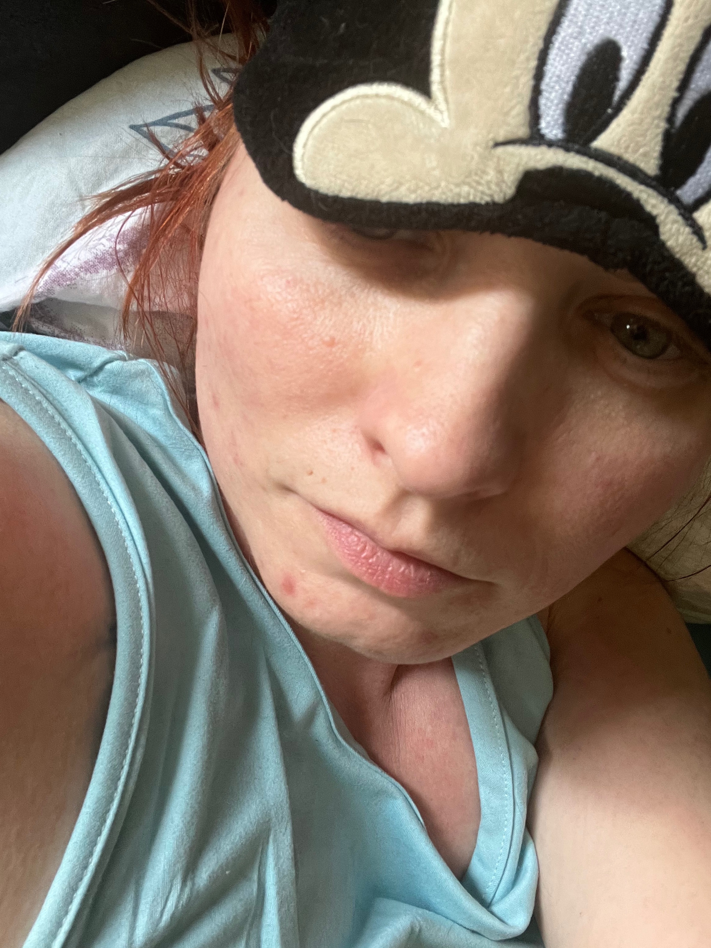 Leben mit MECFS & Blutkrankheit – Hilfe für meine Tests campaign photo, 4 of 7