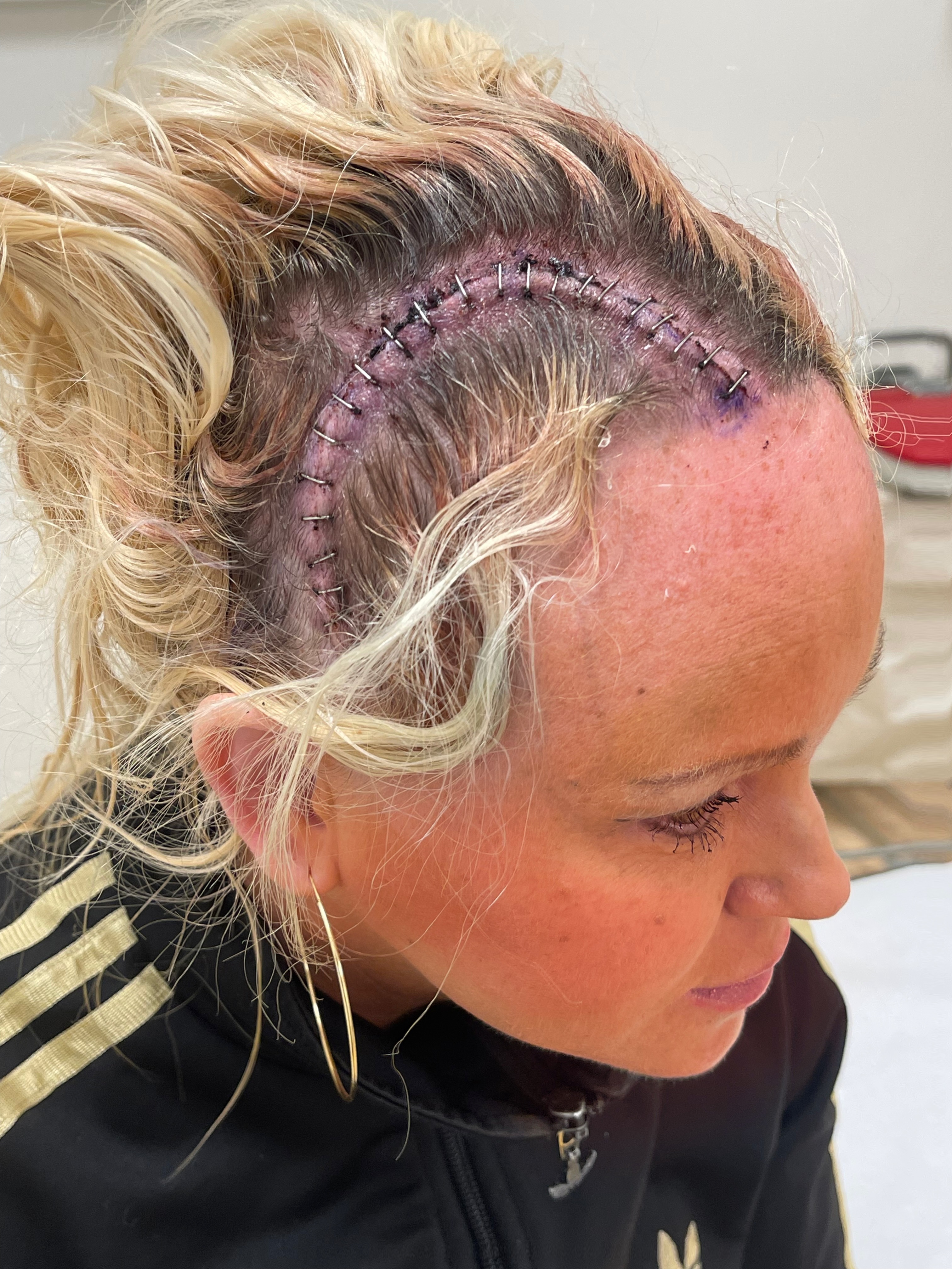 En andra kamp mot cancer! campaign photo, 2 of 5