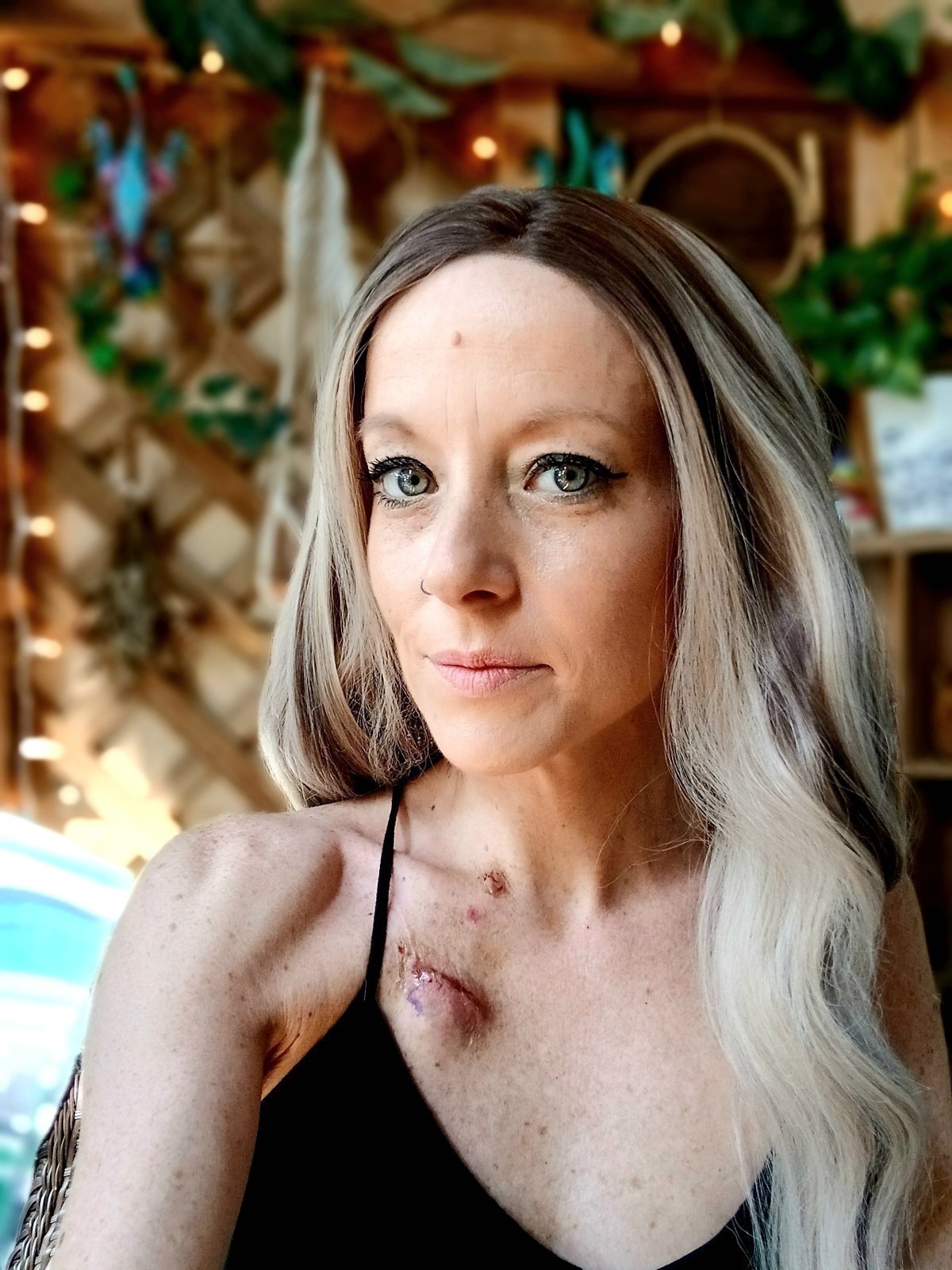 Support Brittany's Fight Against Pots & Eds campaign photo, 2 of 8