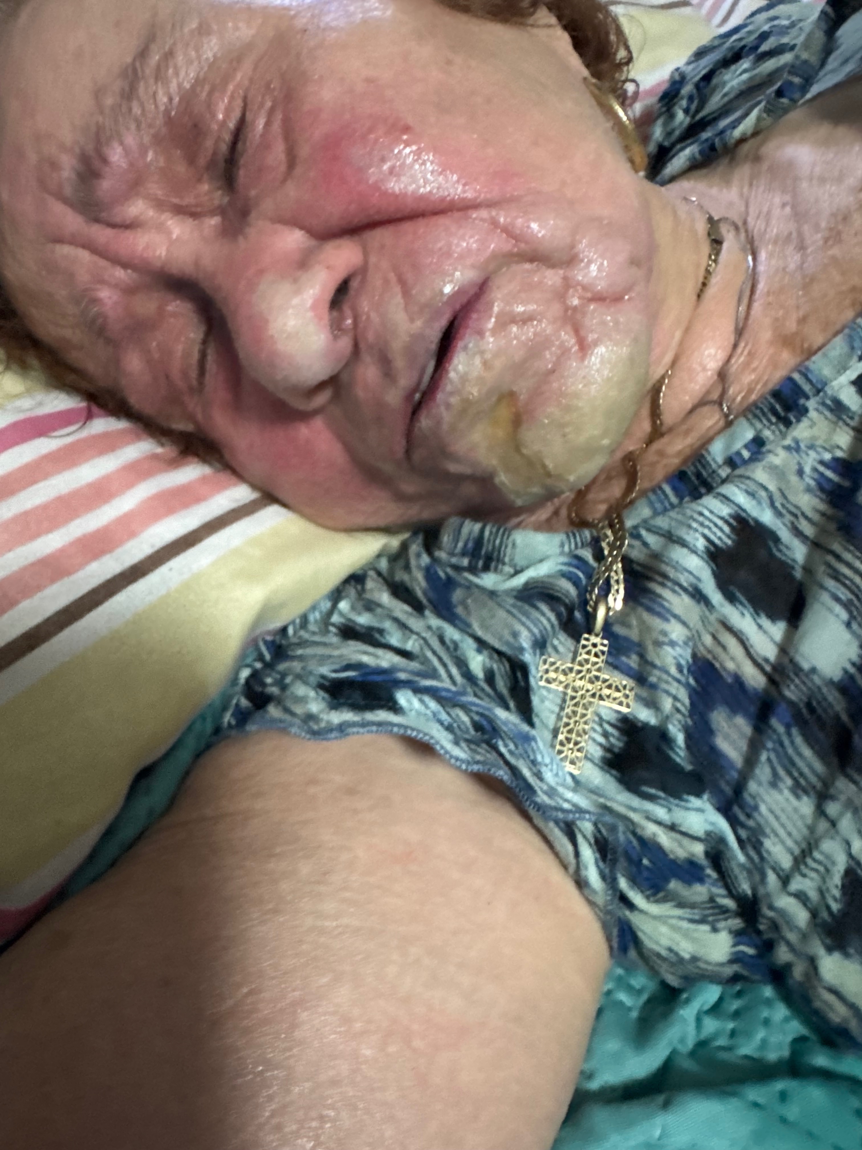 Help Nereida Solivan Heal After Devastating Burn Accident campaign photo, 6 of 7