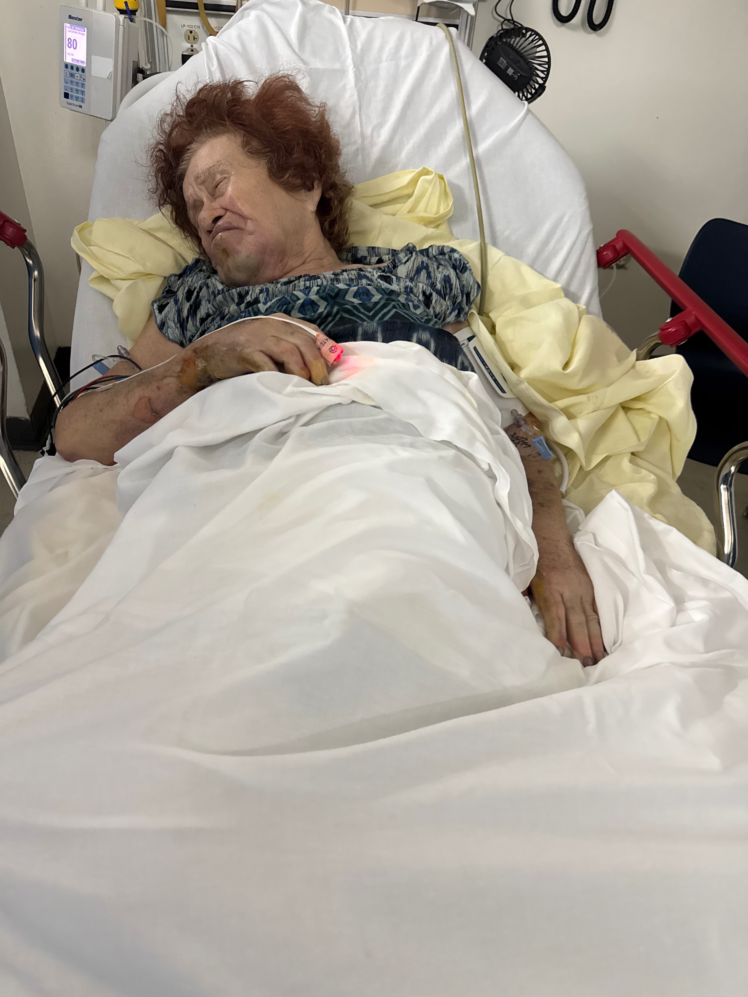 Help Nereida Solivan Heal After Devastating Burn Accident campaign photo, 5 of 7