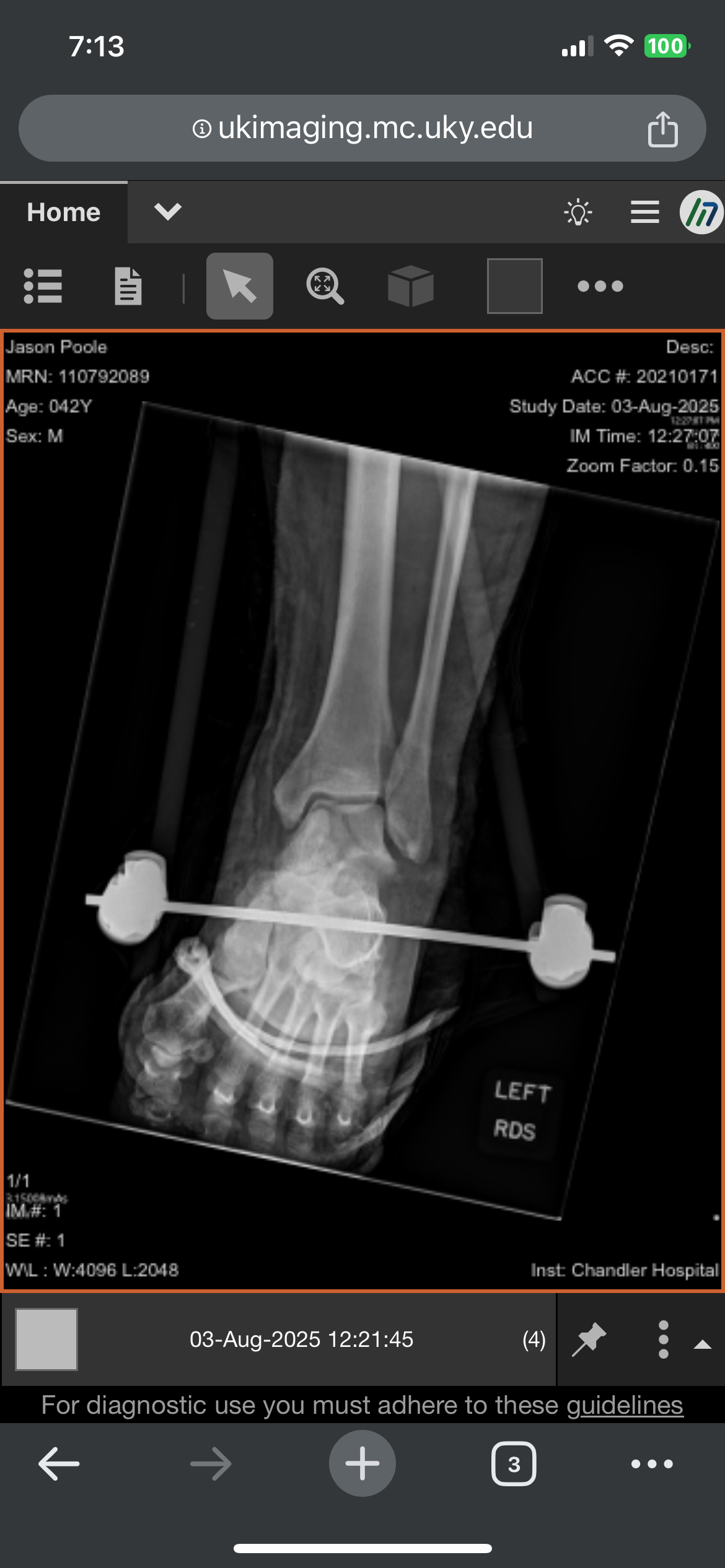 Support Jason's Recovery from Freak Accident campaign photo, 2 of 8
