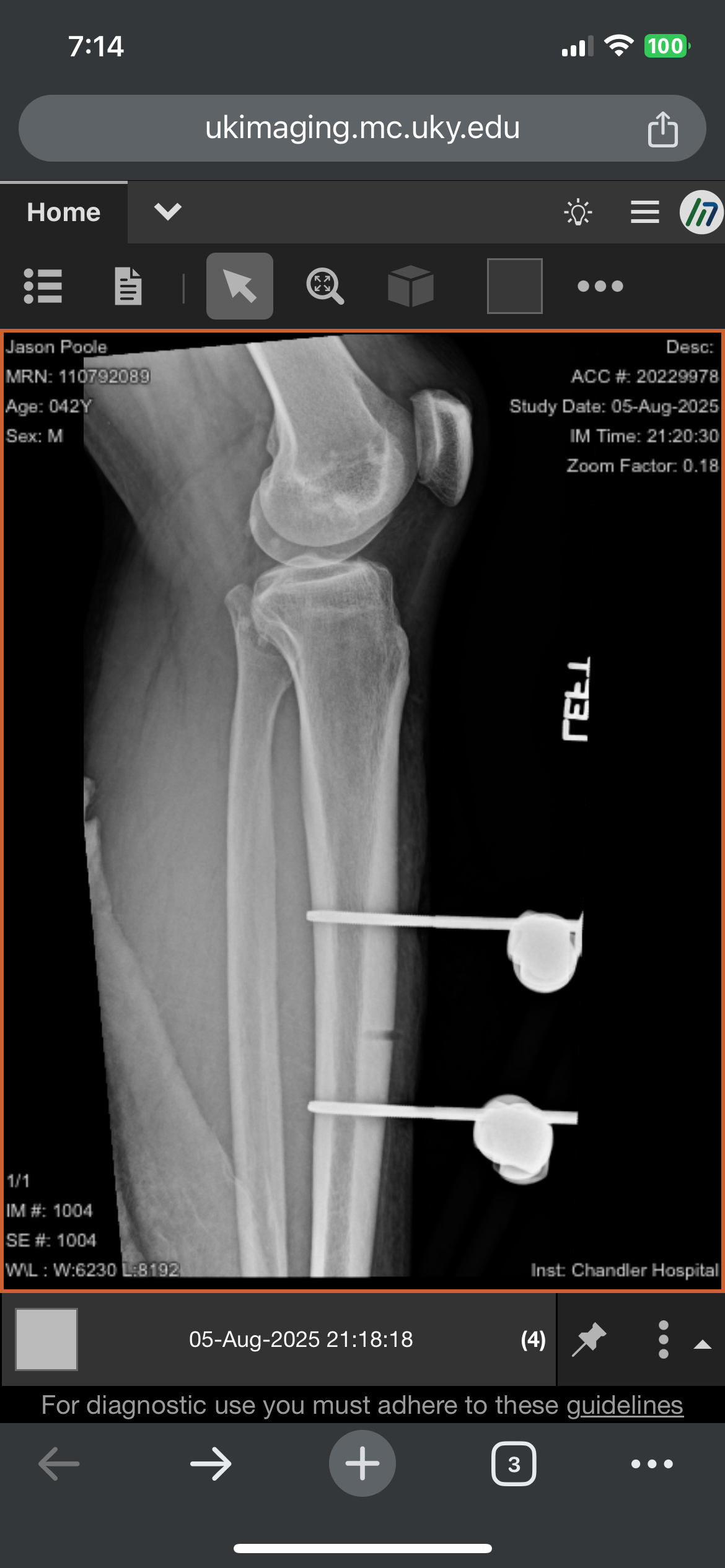 Support Jason's Recovery from Freak Accident campaign photo, 4 of 8