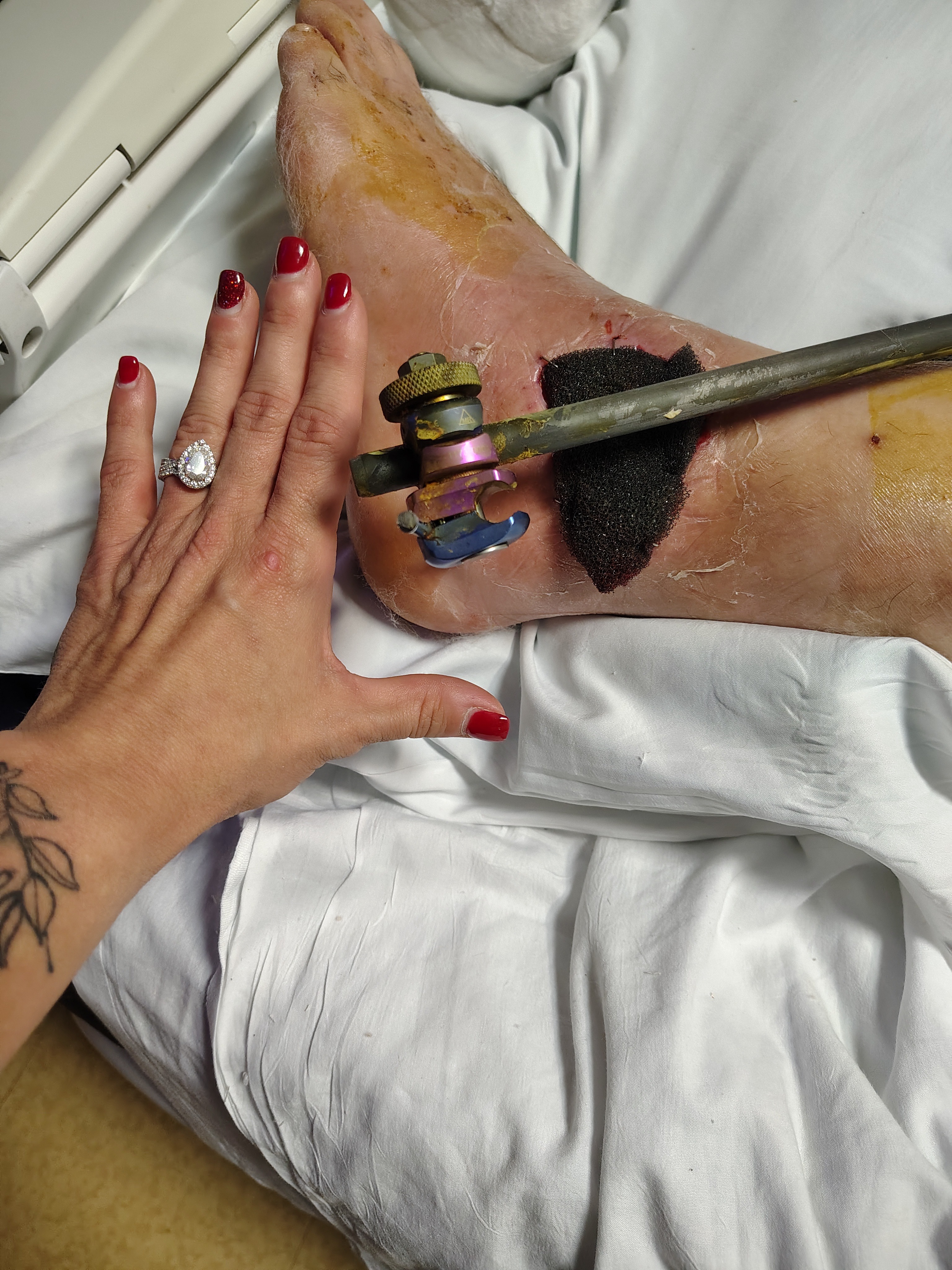 Support Jason's Recovery from Freak Accident campaign photo, 6 of 8