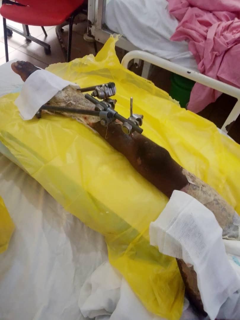 Help Save 6-Year-Old's Life and Leg campaign photo, 2 of 7