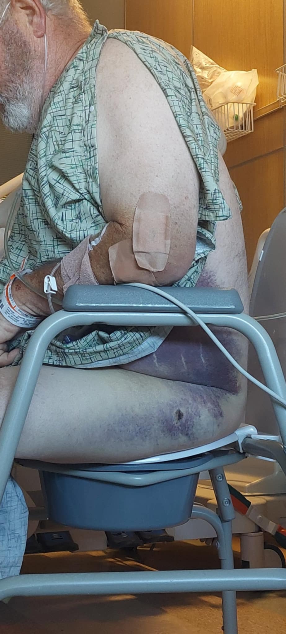 Rally for Scott's Recovery: Medical Expenses campaign photo, 2 of 8