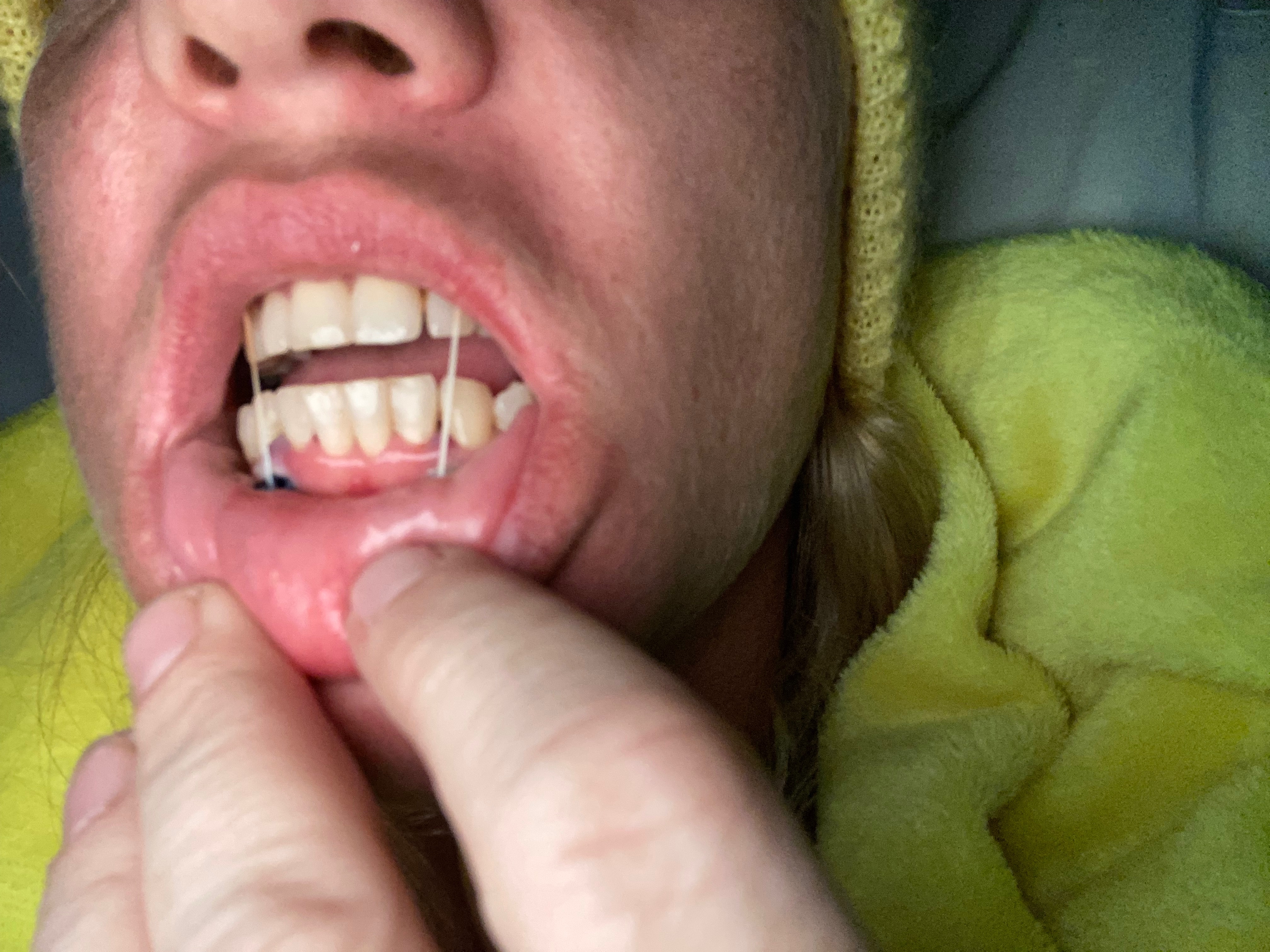 Get me into safe accommodation and help me heal campaign photo, 4 of 6