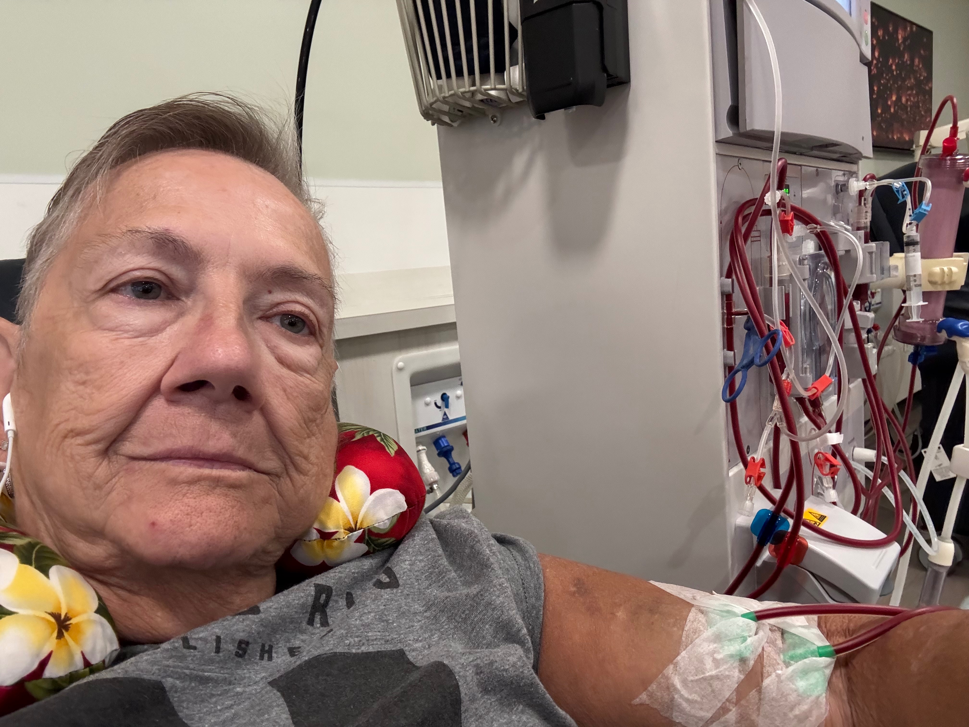 Help Anna Get a Life-Saving Kidney Transplant campaign photo, 6 of 6