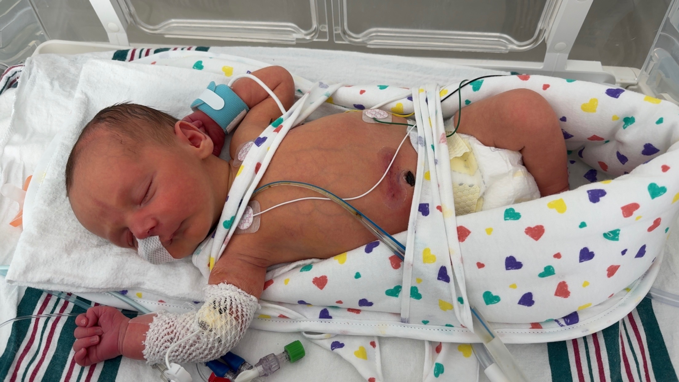 Support Baby Colton's NICU Journey campaign photo, 2 of 4