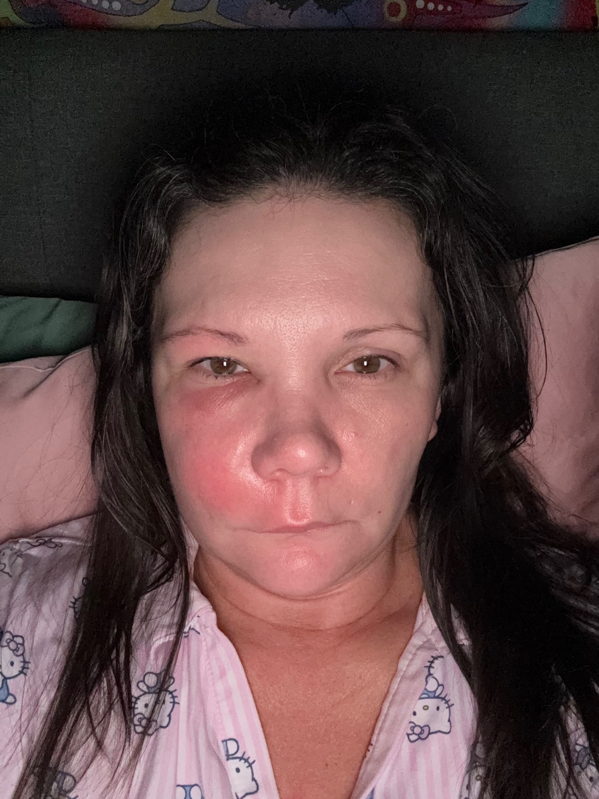 Aid Lindsay's Critical Dental Surgery Fund campaign photo, 2 of 8