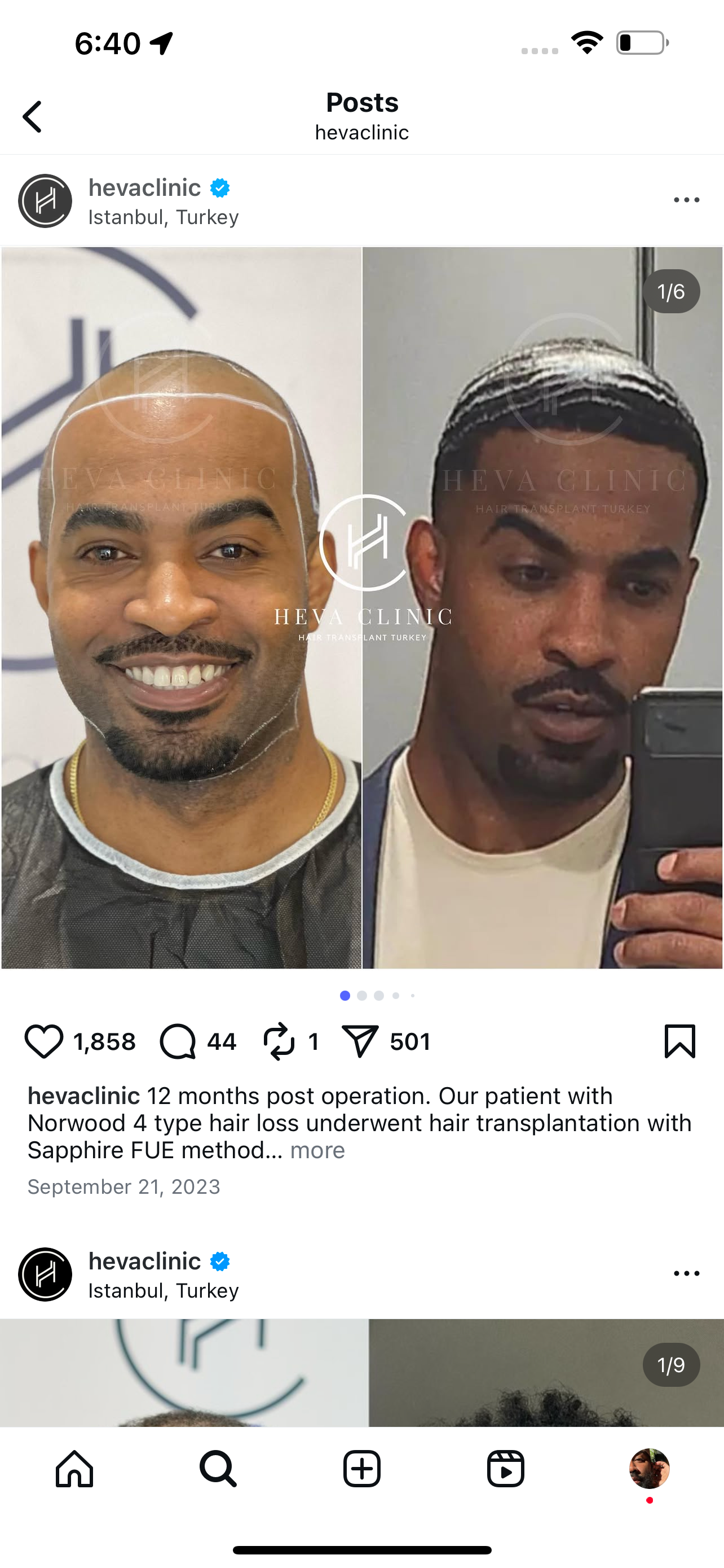 Fun Raisor Hair Fundraiser by Sean Scott : Support My Radiant Hair Restoration Journey