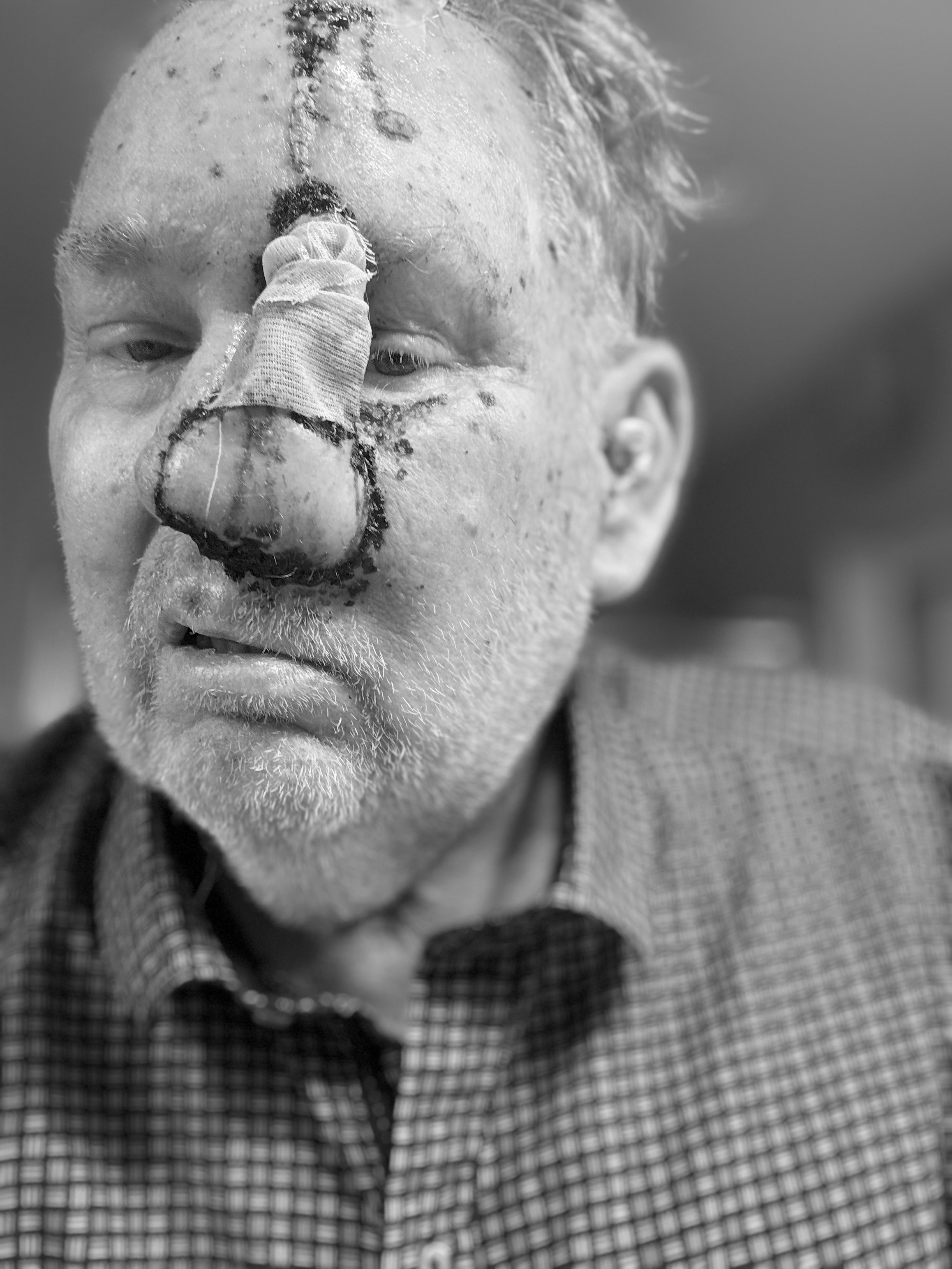 Help Fred Fight Cancer-Support Surgery and Recovery Costs. campaign photo, 4 of 8