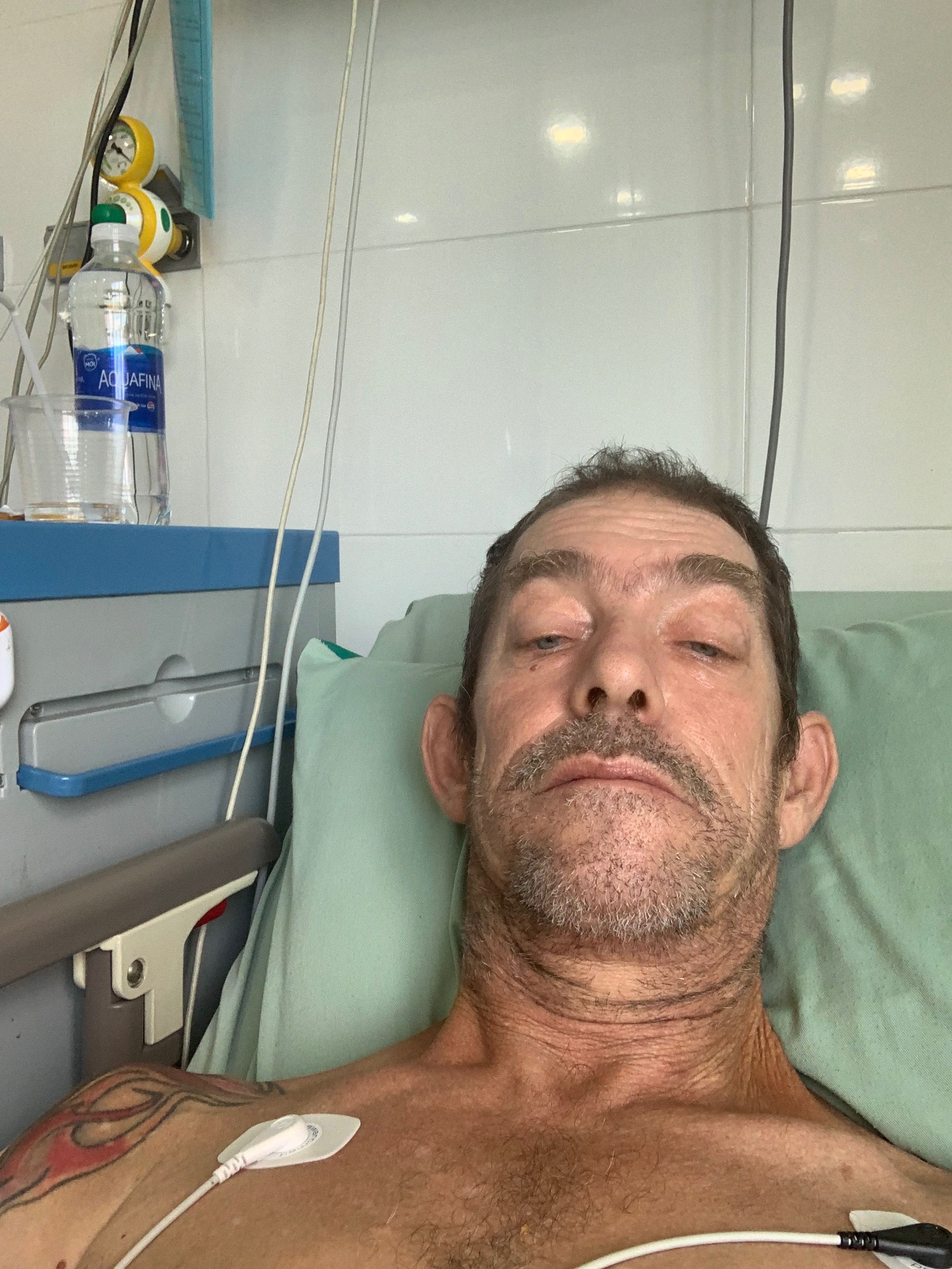 Support David Houser for skate injury and robbery in Vietnam campaign photo, 4 of 7