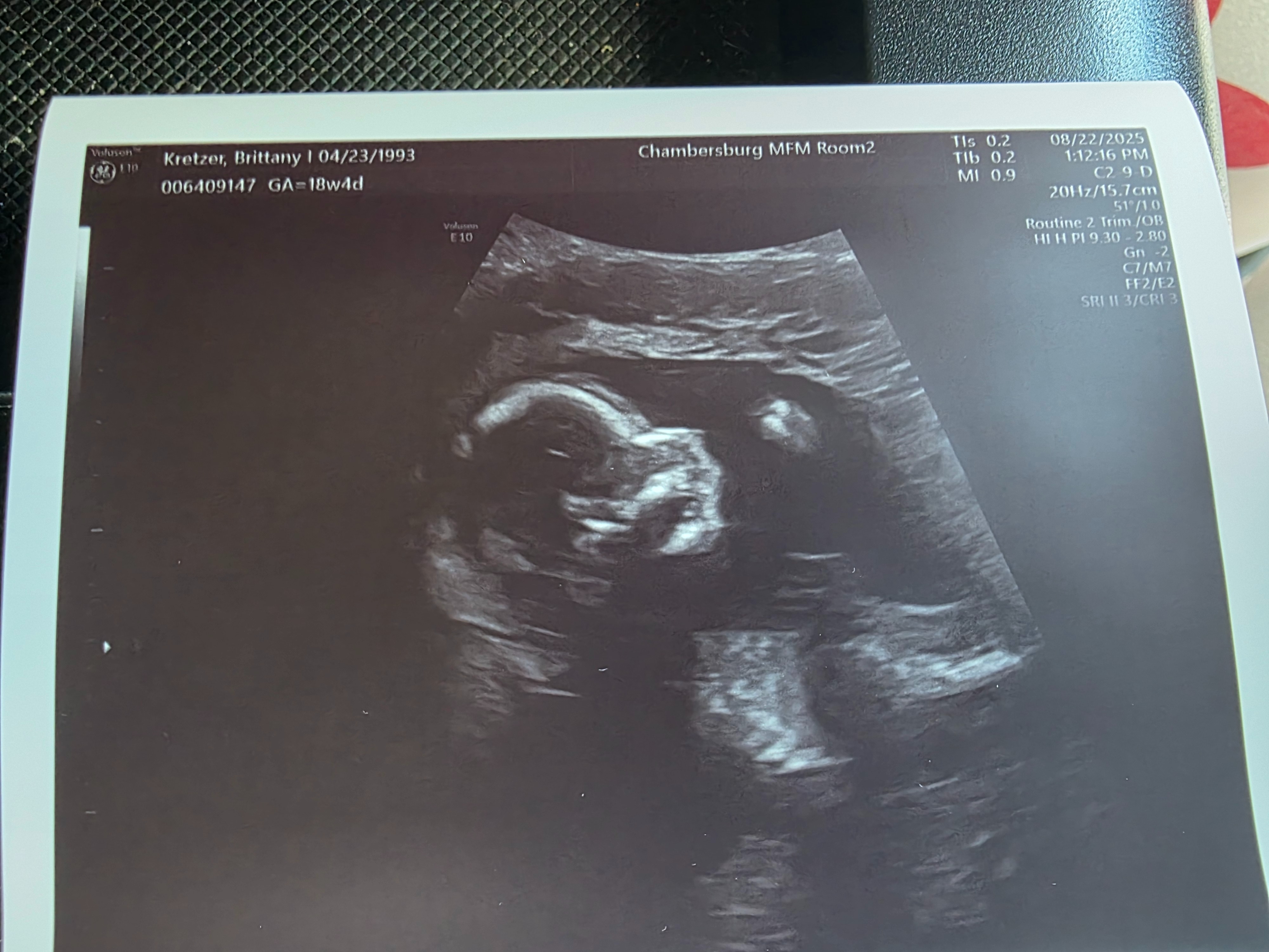 Help Cory & Brittanys Health Issues & Safety of Baby Boy campaign photo, 6 of 7