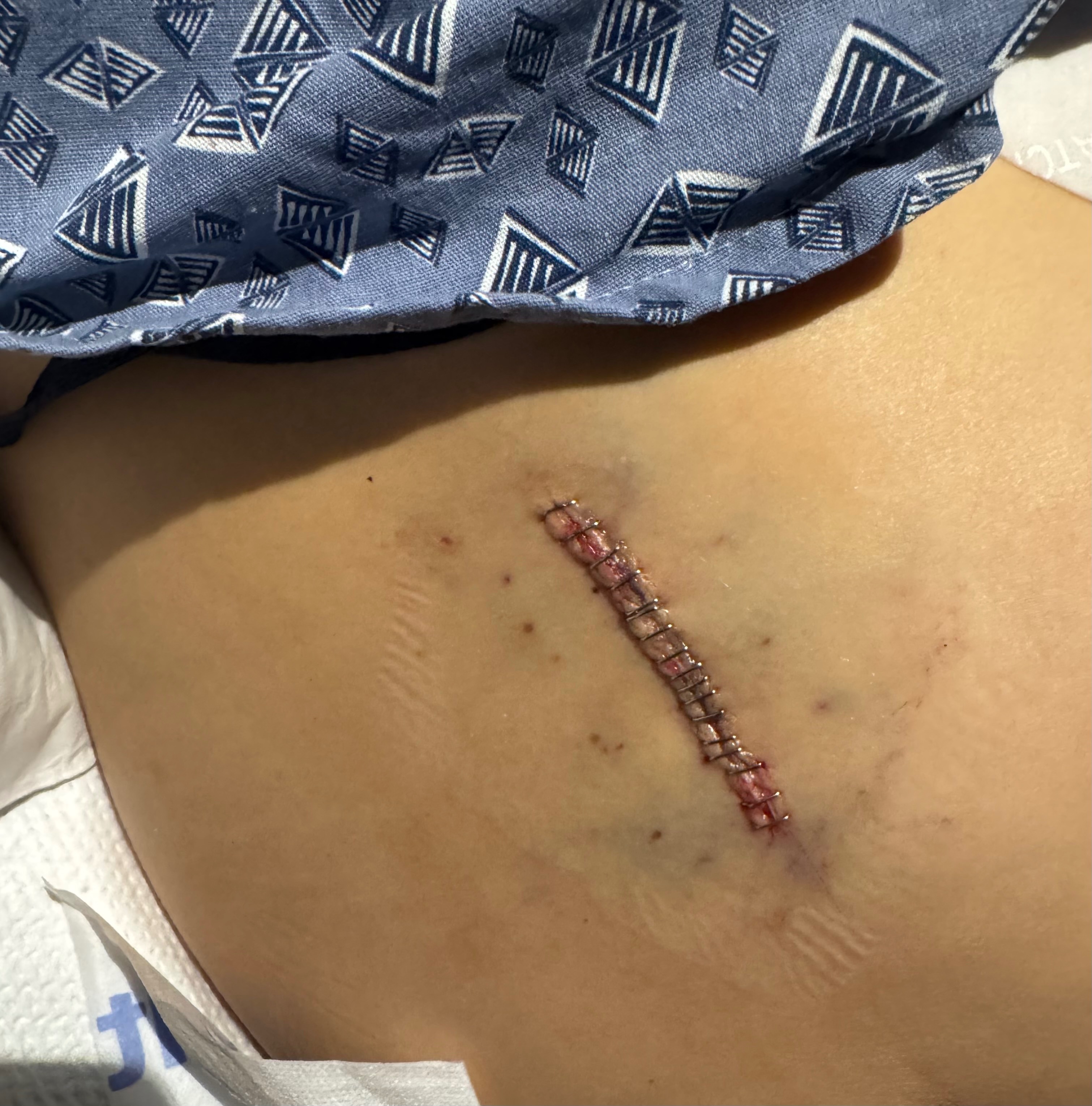 Help Brianna recover from emergency surgery campaign photo, 2 of 7