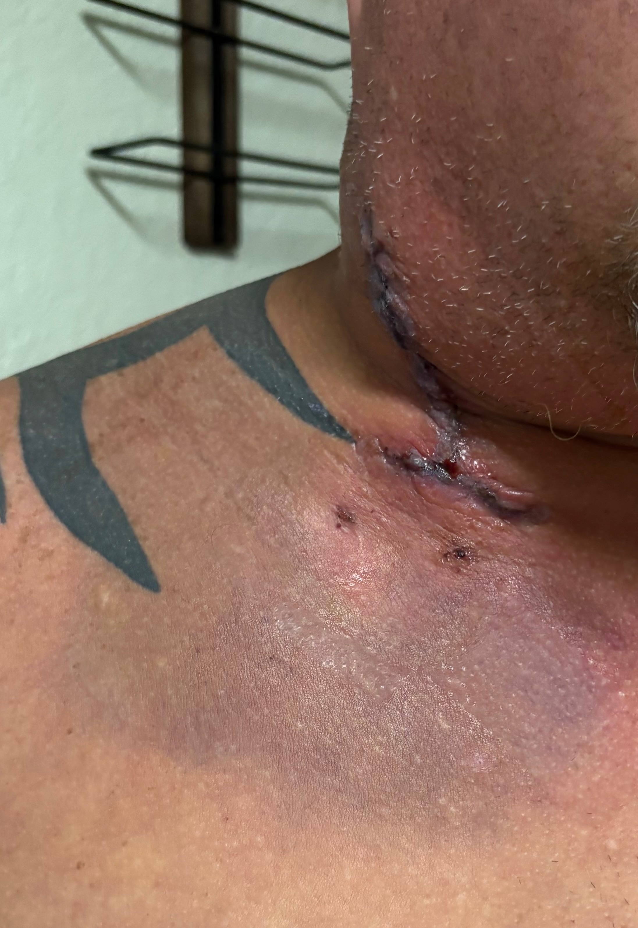 Support Ken's Recovery After 10 Strokes campaign photo, 2 of 6