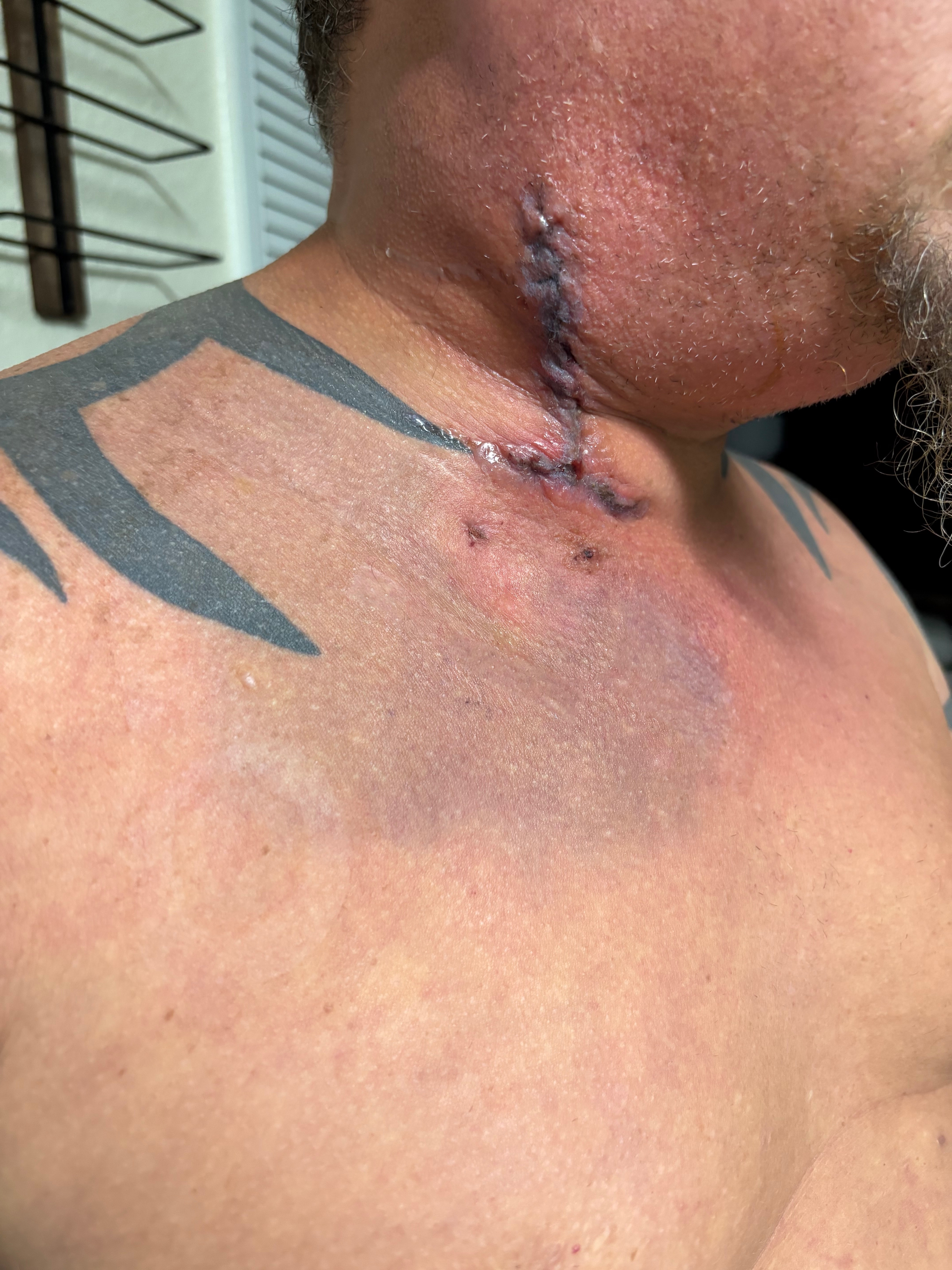 Support Ken's Recovery After 10 Strokes campaign photo, 4 of 6