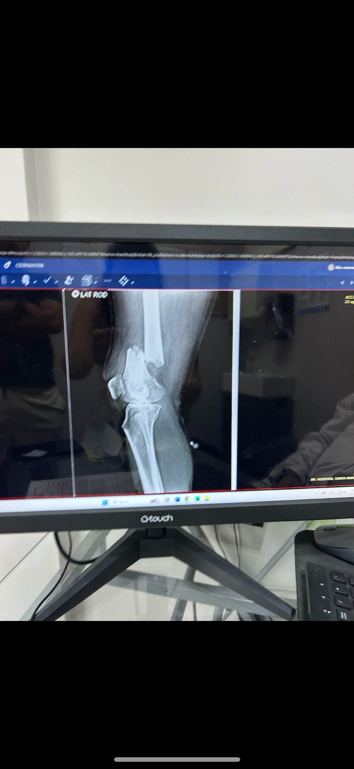 Support Dad's Recovery After Horrific Accident campaign photo, 2 of 6