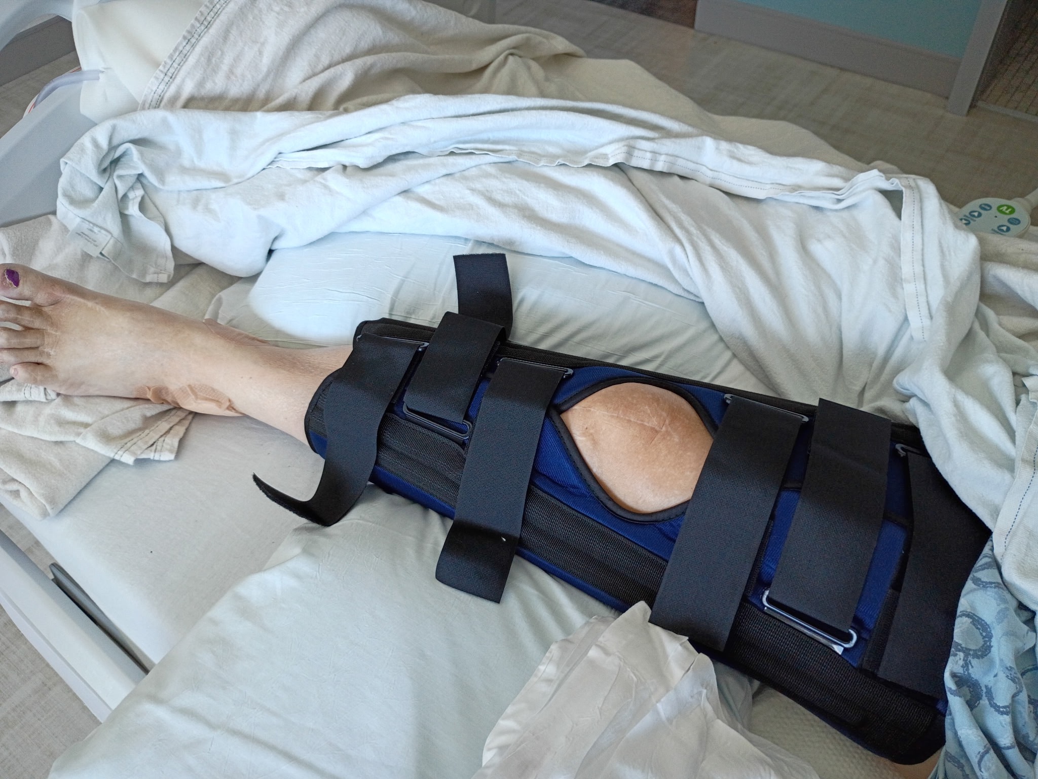Alice Needs Your Help for Medical Costs campaign photo, 2 of 4