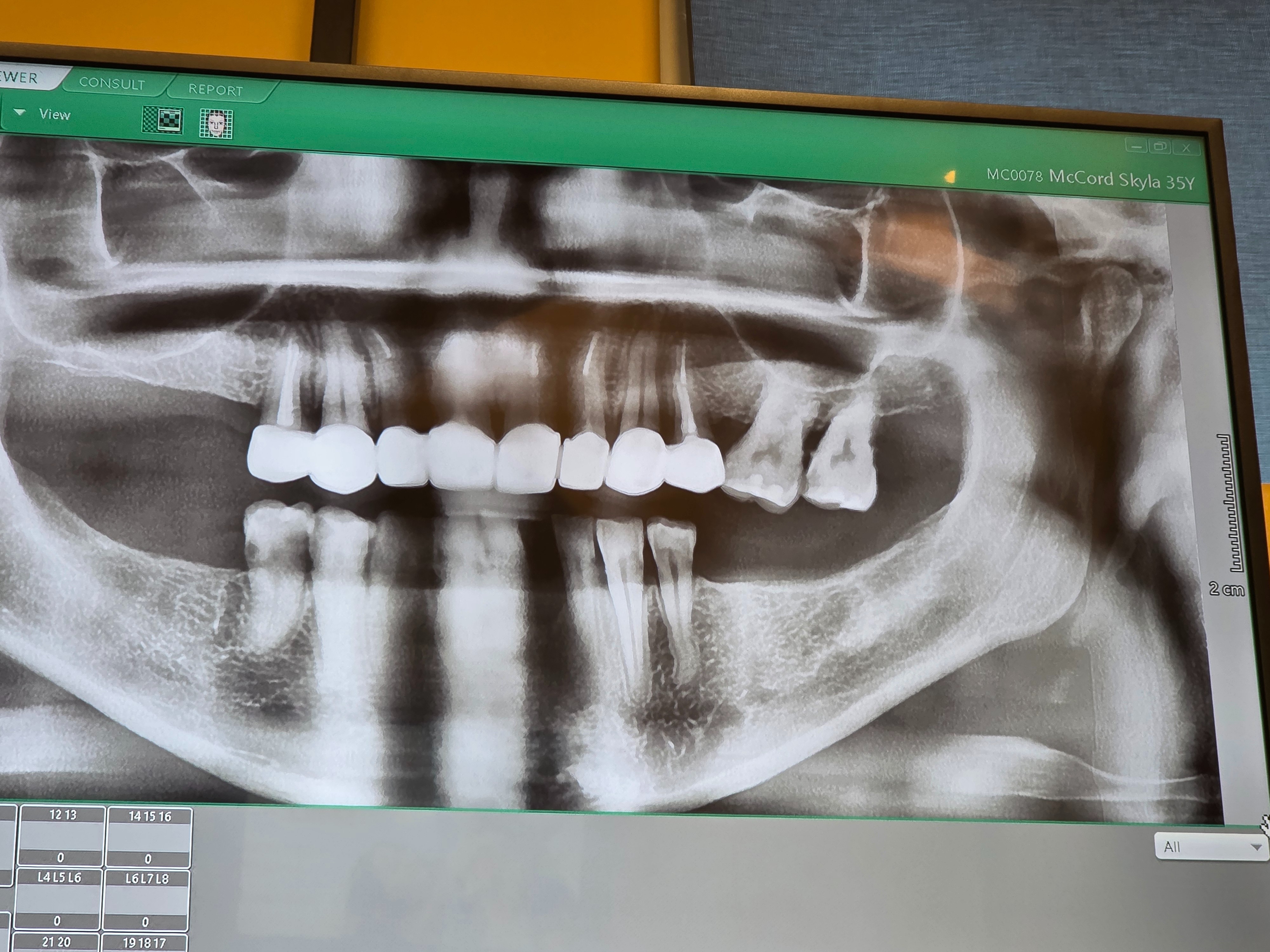 Help Me Smile & Eat Again – Urgent Dental Surgery Needed campaign photo, 5 of 6