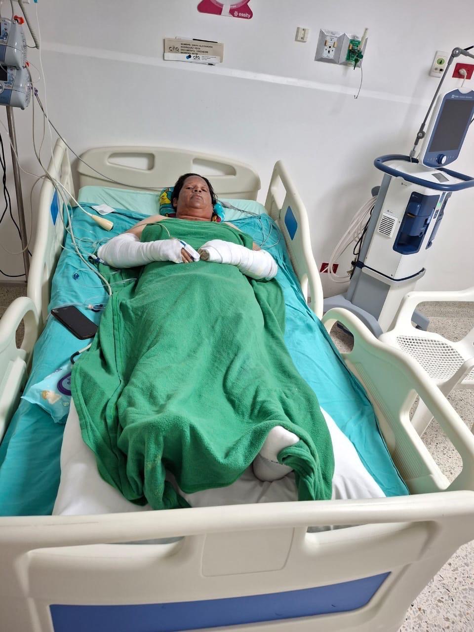 Help Diana Recover After a Gas Explosion in Cúcuta Colombia campaign photo, 2 of 7
