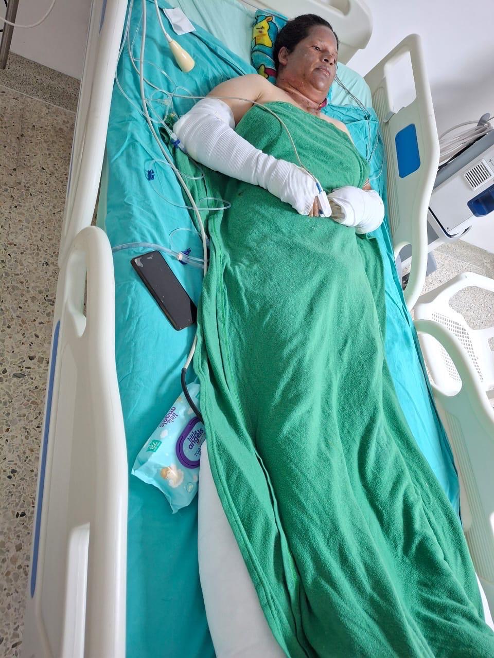 Help Diana Recover After a Gas Explosion in Cúcuta Colombia campaign photo, 5 of 7