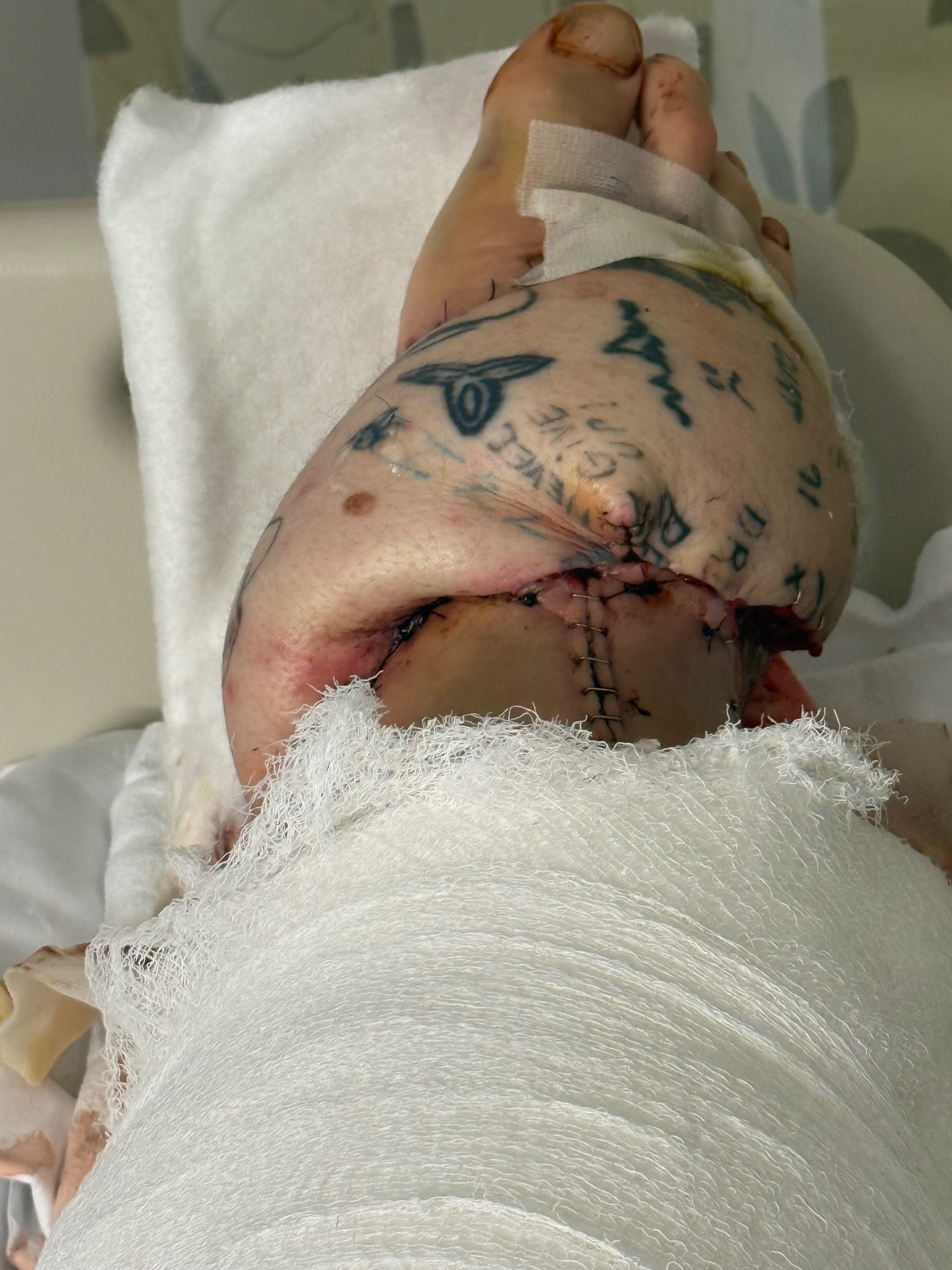 Help Tristyn Heal: Overcoming a Life-Altering Accident campaign photo, 2 of 8