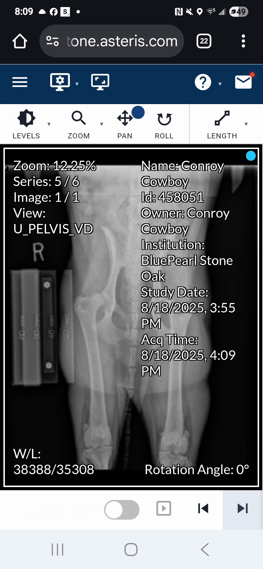 Donate to Cowboy's Life-Changing Hip Surgery campaign photo, 4 of 8