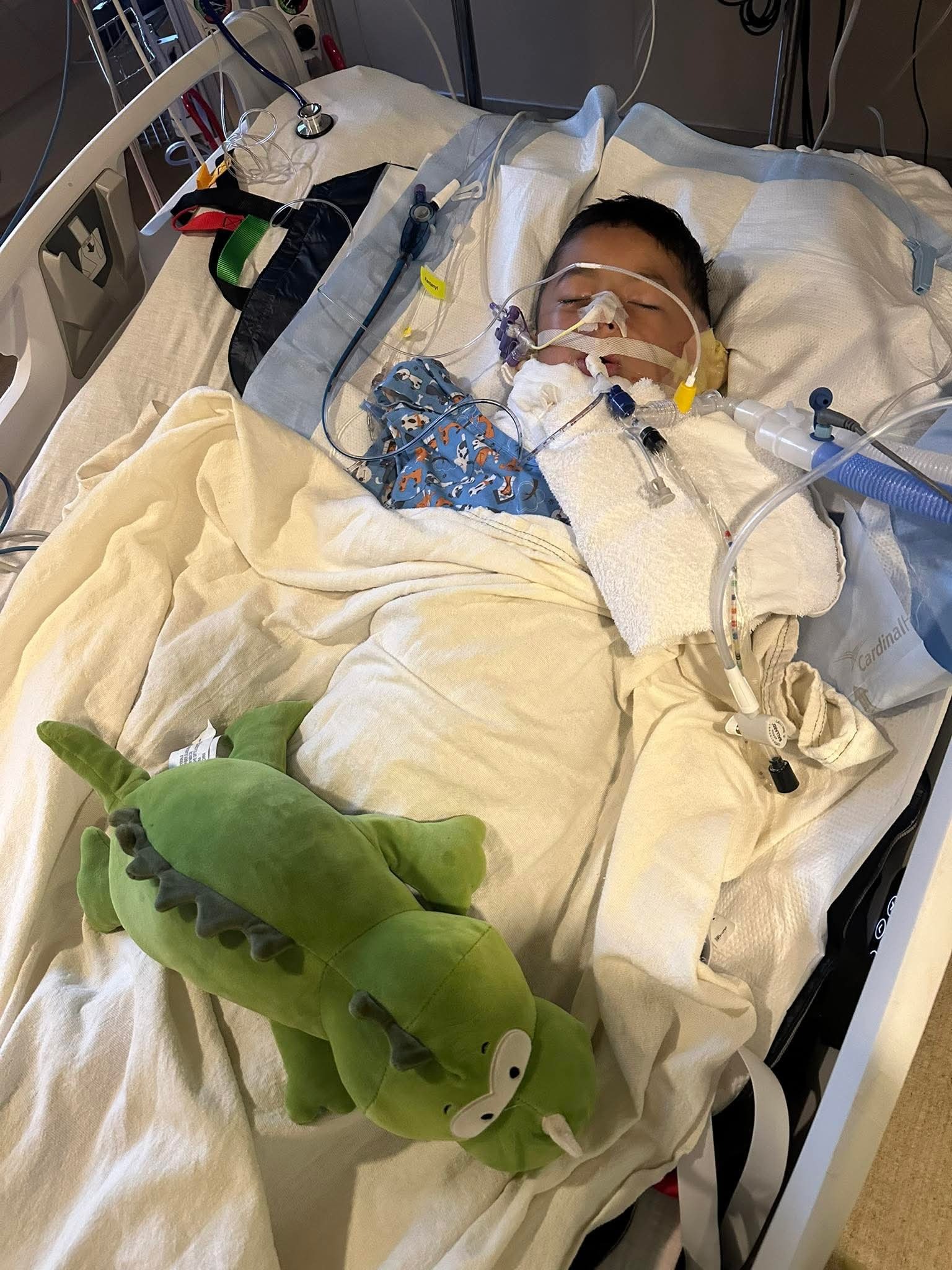 Support Luka's Recovery from Severe Burns campaign photo, 2 of 4