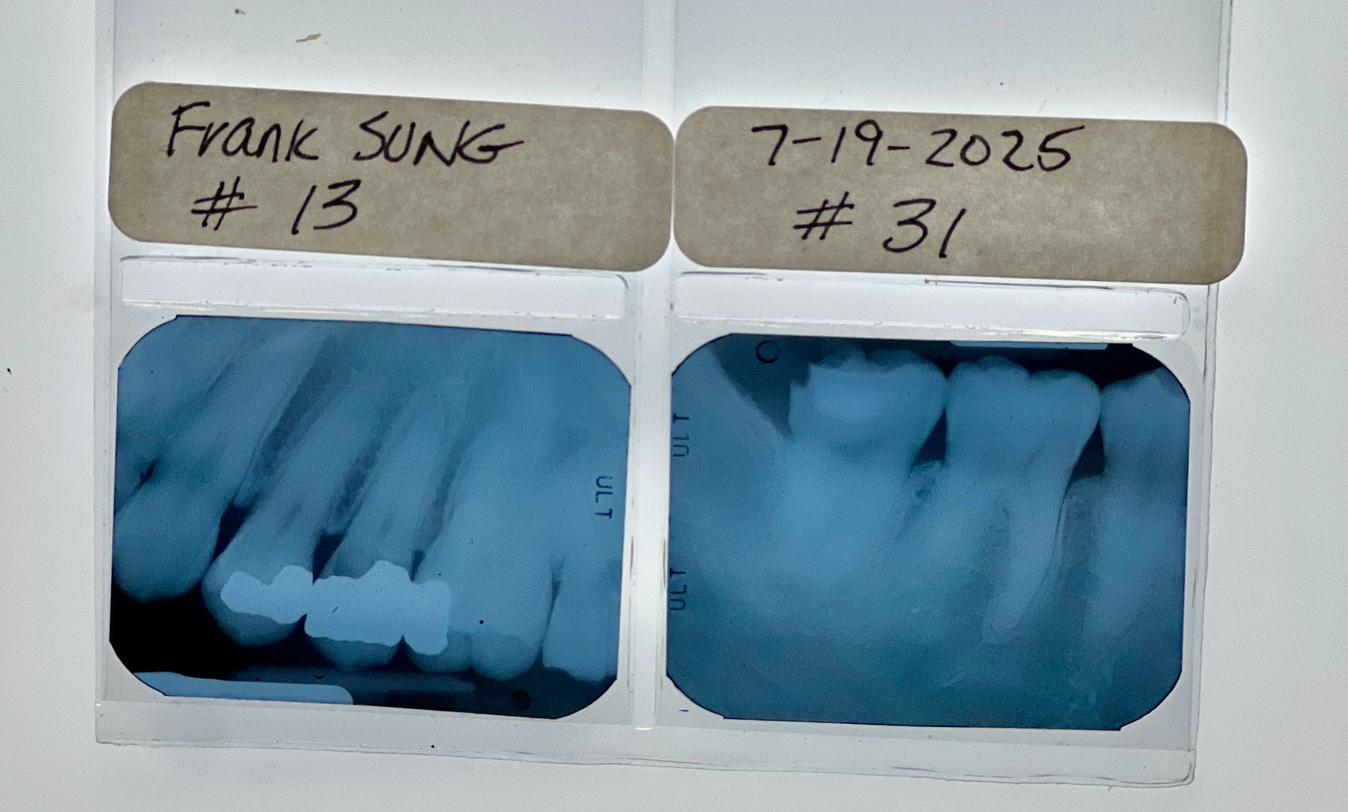 Two Root Canals: Need Your Help campaign photo, 4 of 6