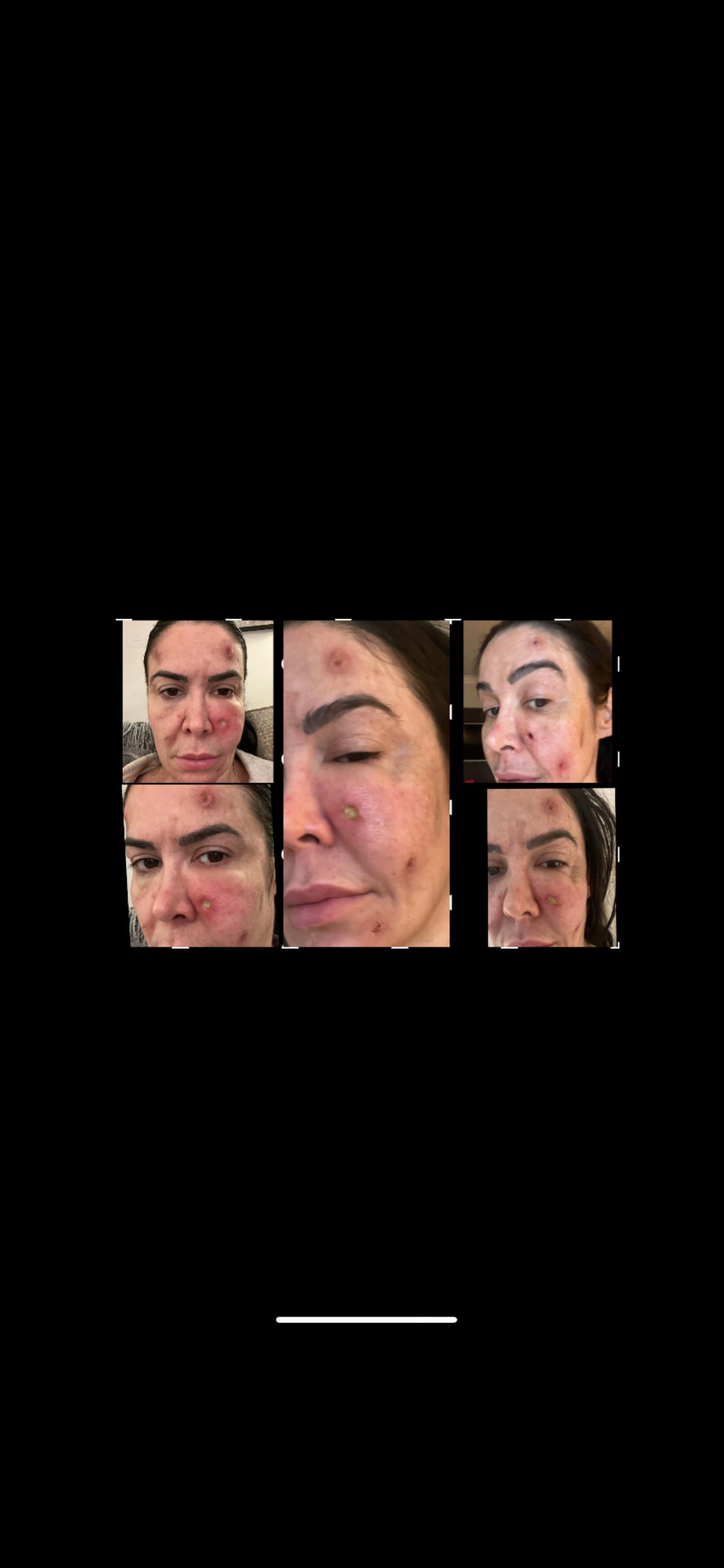 Donate to help me recovery my skin and come back to work! campaign photo, 7 of 8